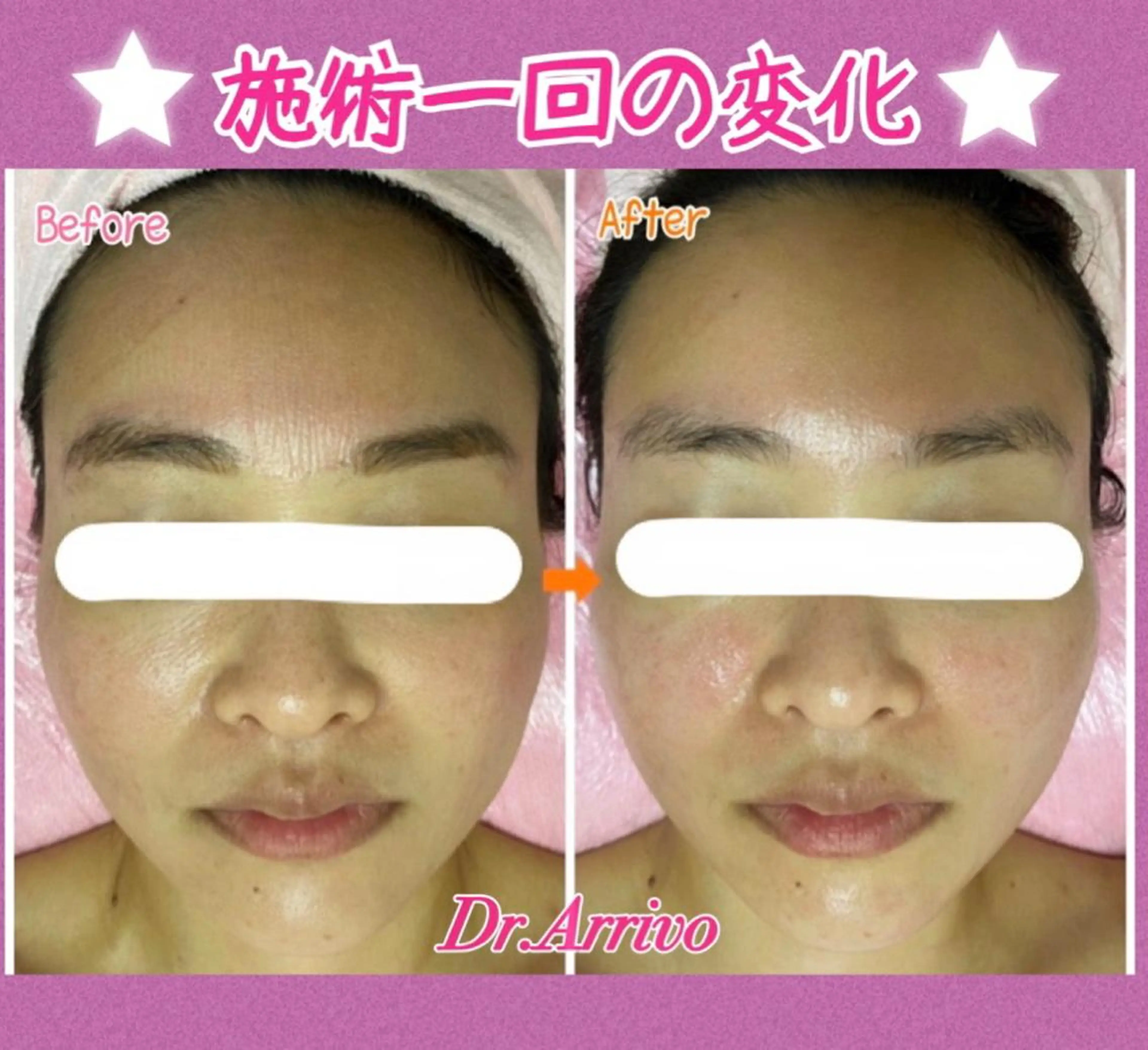 セミロング カラー パーマ ヘアアレンジ メンズ キッズ ネイル マツエク・マツパ 赤色 ‍痩身＆ボディ 結果出し🌟丹野のエステ・リラクイメージ