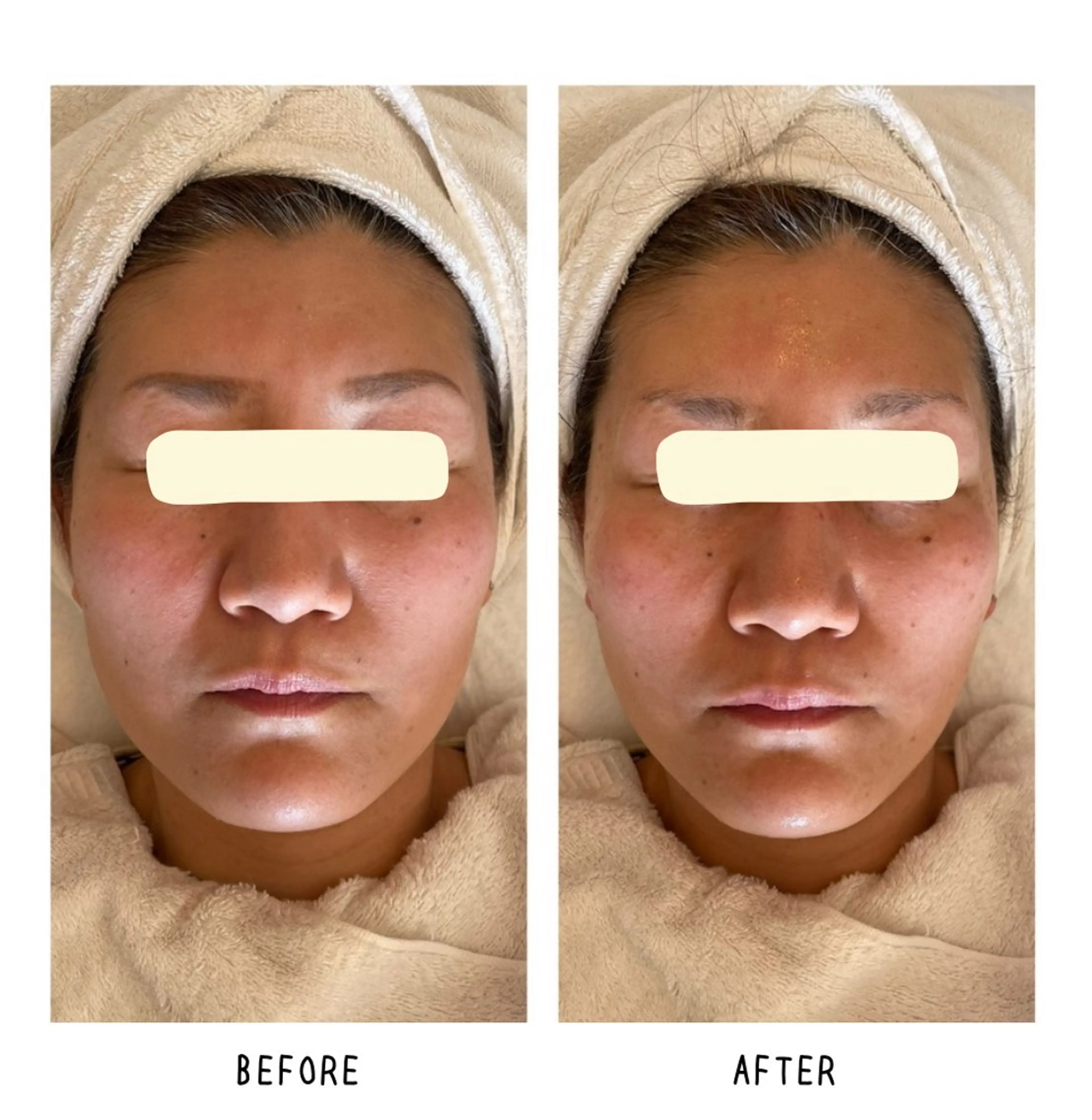 grow所属・Yoshino Erinaのエステ・リラクイメージ