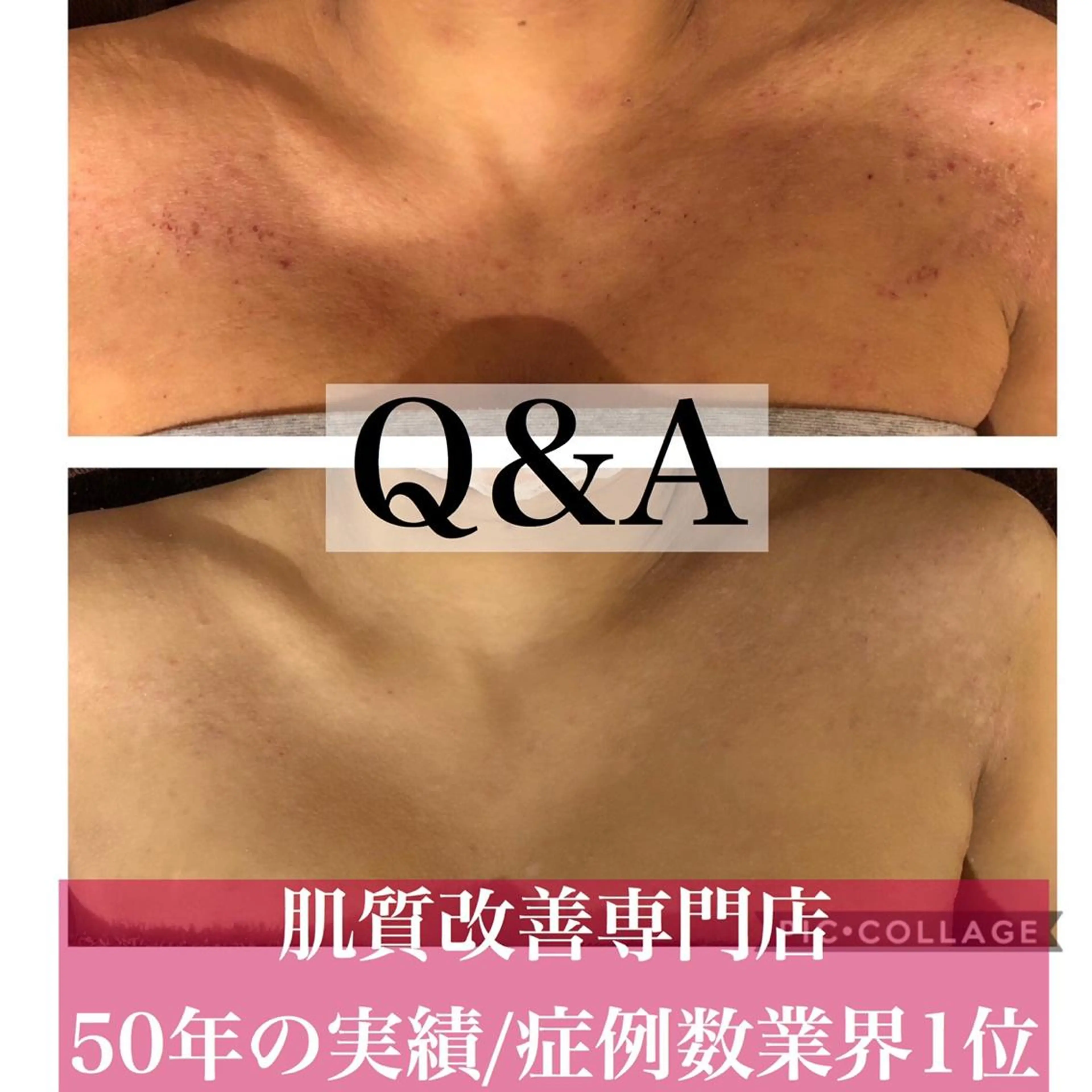 ミディアム カラー パーマ ヘアアレンジ メンズ キッズ ネイル マツエク・マツパ エステ リラク ニキビ・肌質改善専門 ♡人生が変わるサロンのエステ・リラクイメージ