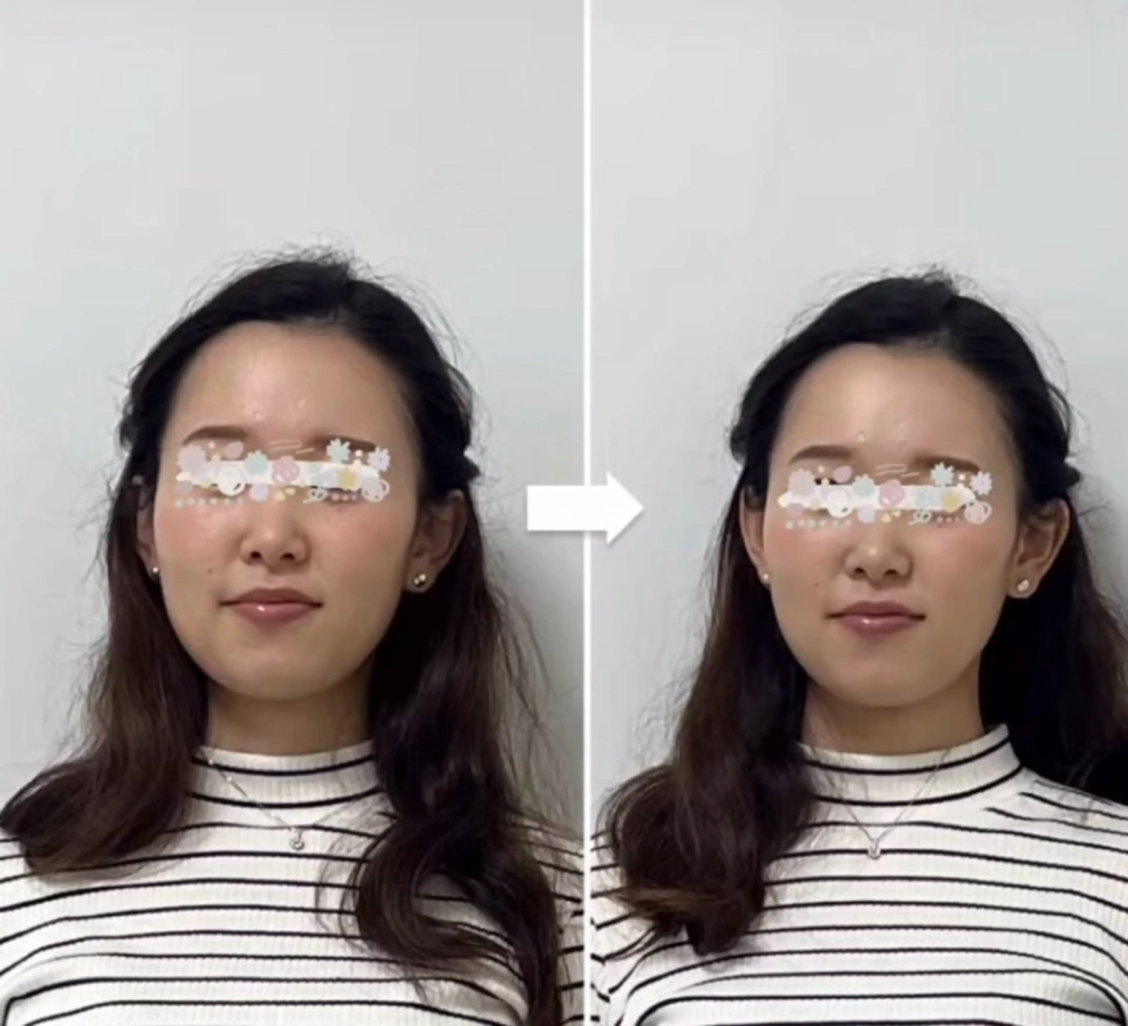 期間限定💍ヘッドスパ・小顔矯正💆‍♀️頭痛・肩凝りのお悩みの方の写真