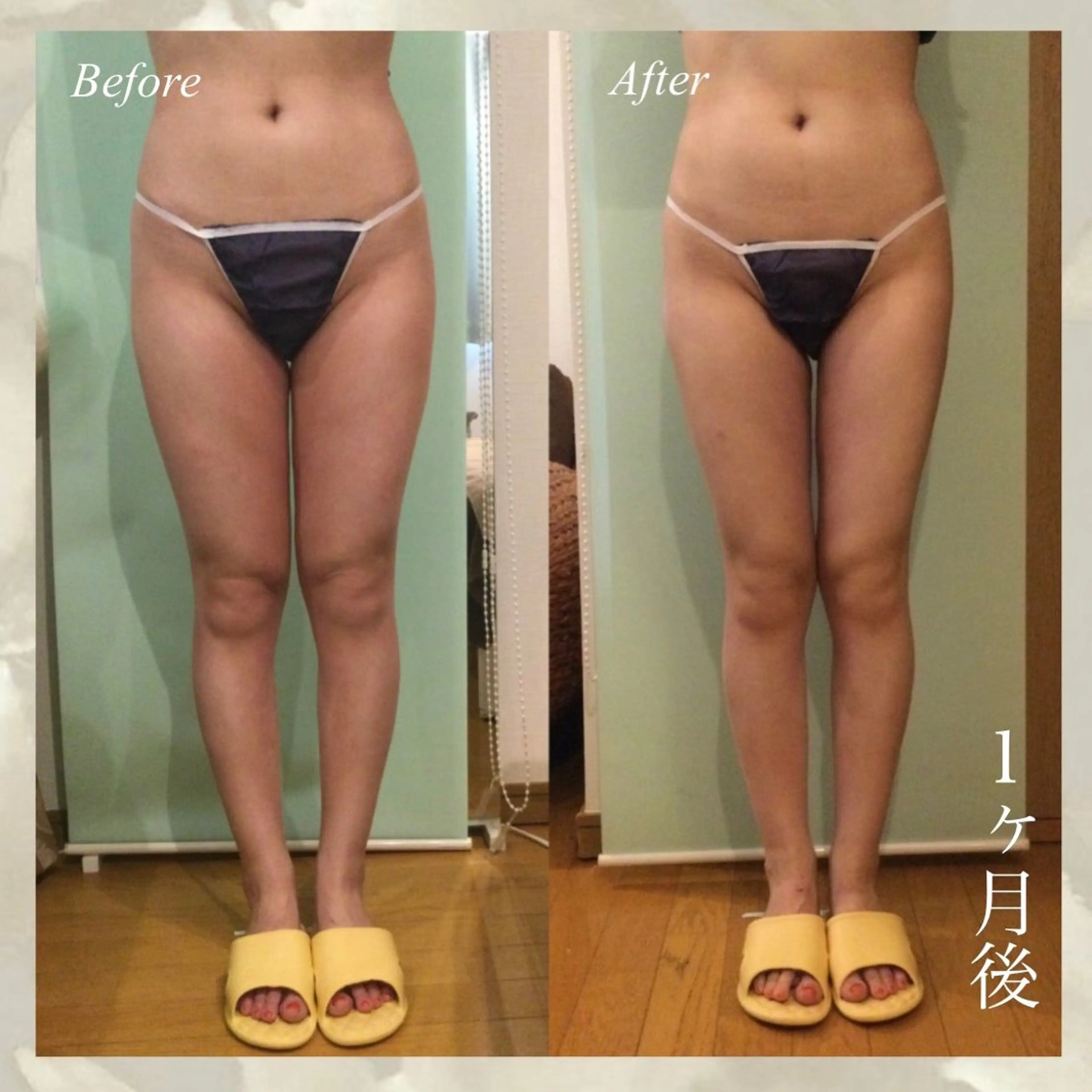 45分【下半身】術後ケア 新規／4500円　再来/5200円【顔、上半身不可】◆15分延長2000円の写真