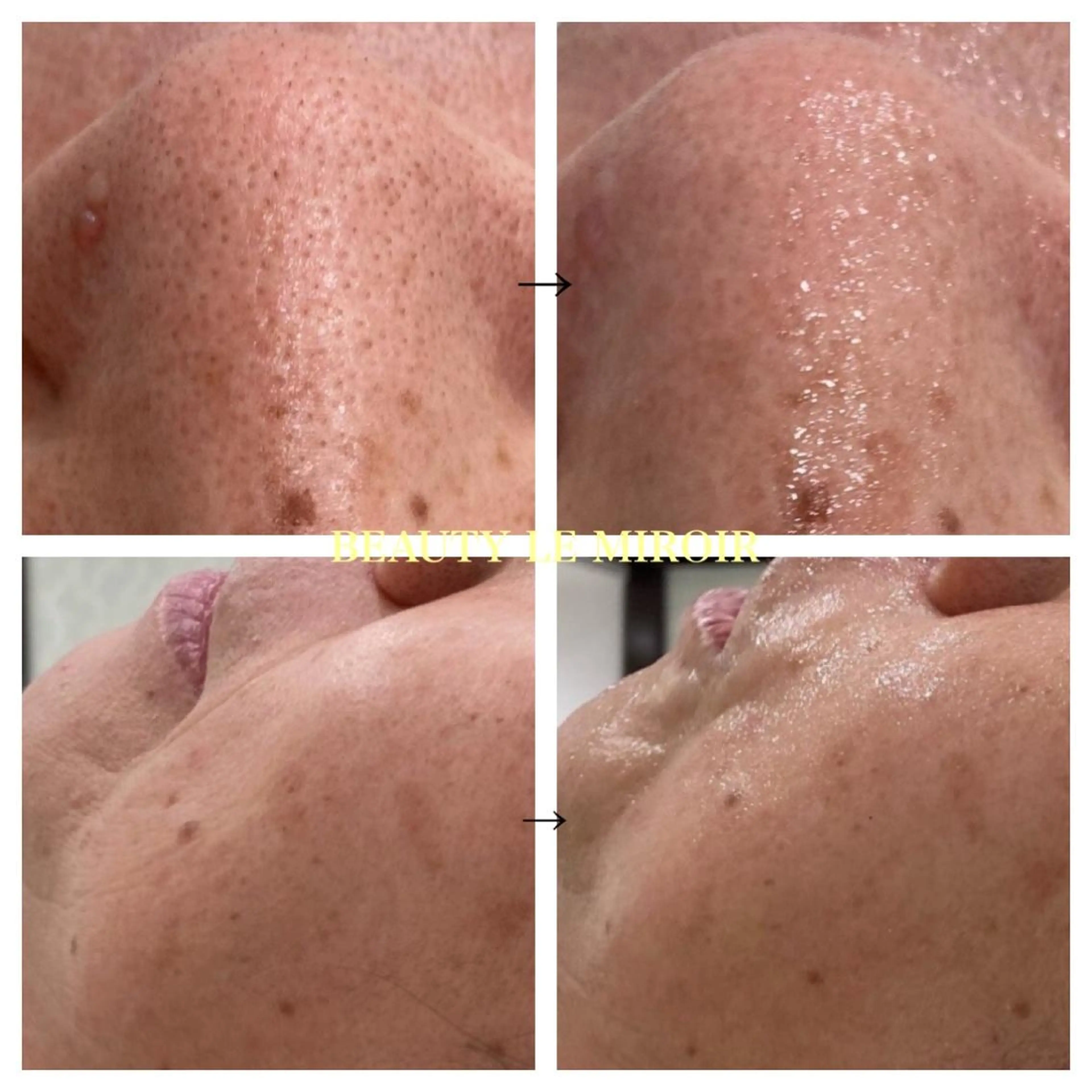 エステ ビューティー ミロワールのエステ・リラクイメージ