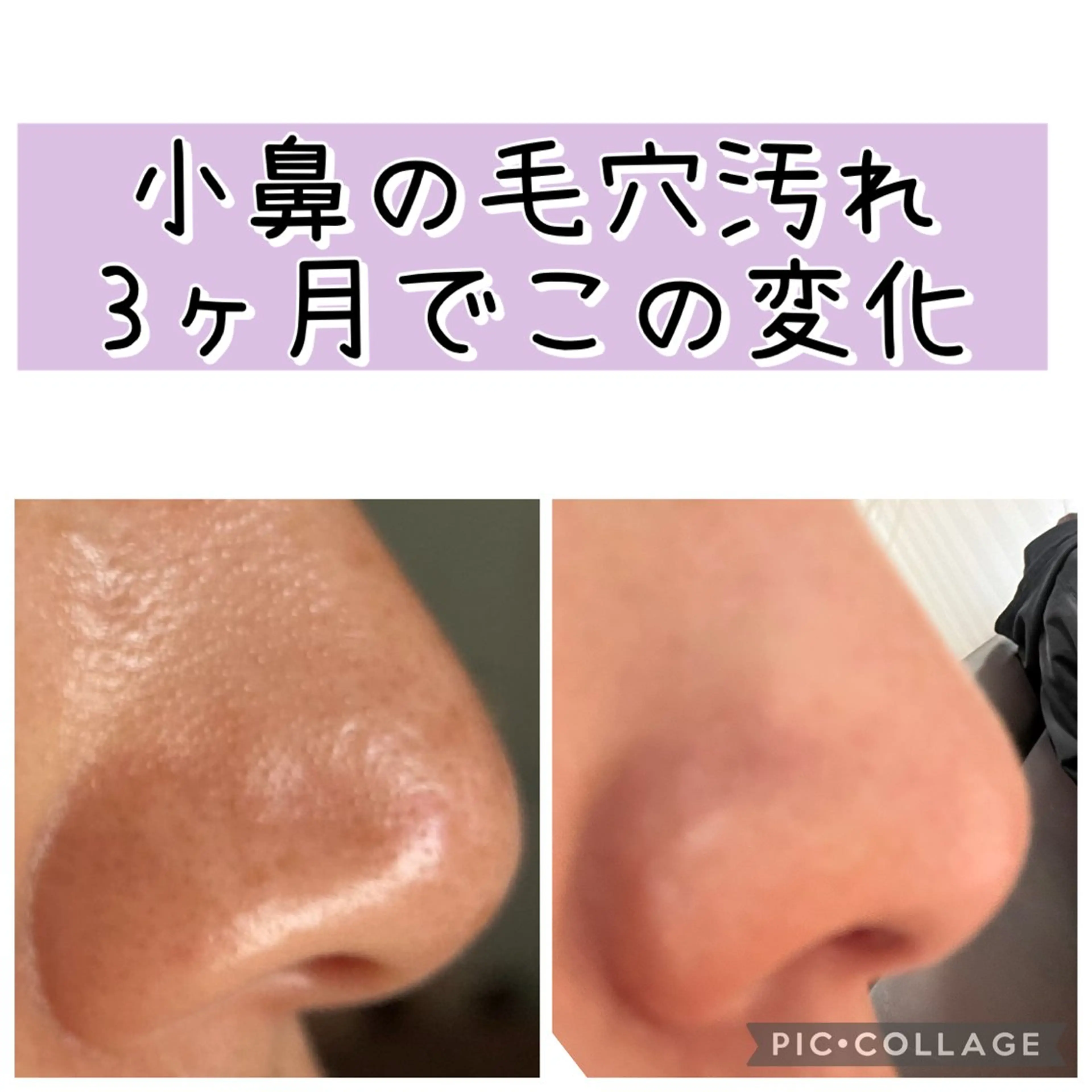 メナードフェイシャル サロンmakiのエステ・リラクイメージ