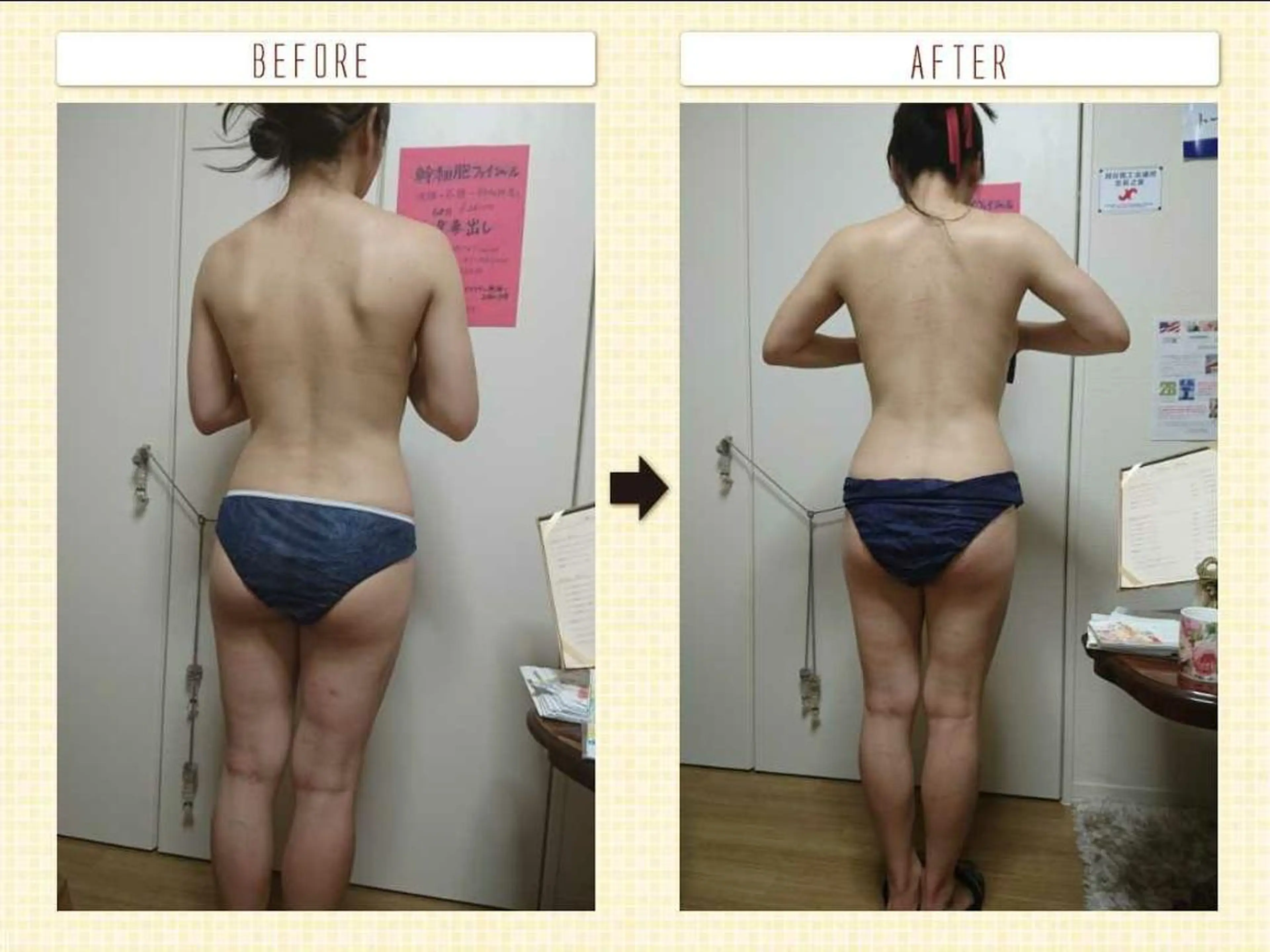 エステ Arebeau 痩身&体質改善&健康のエステ・リラクイメージ