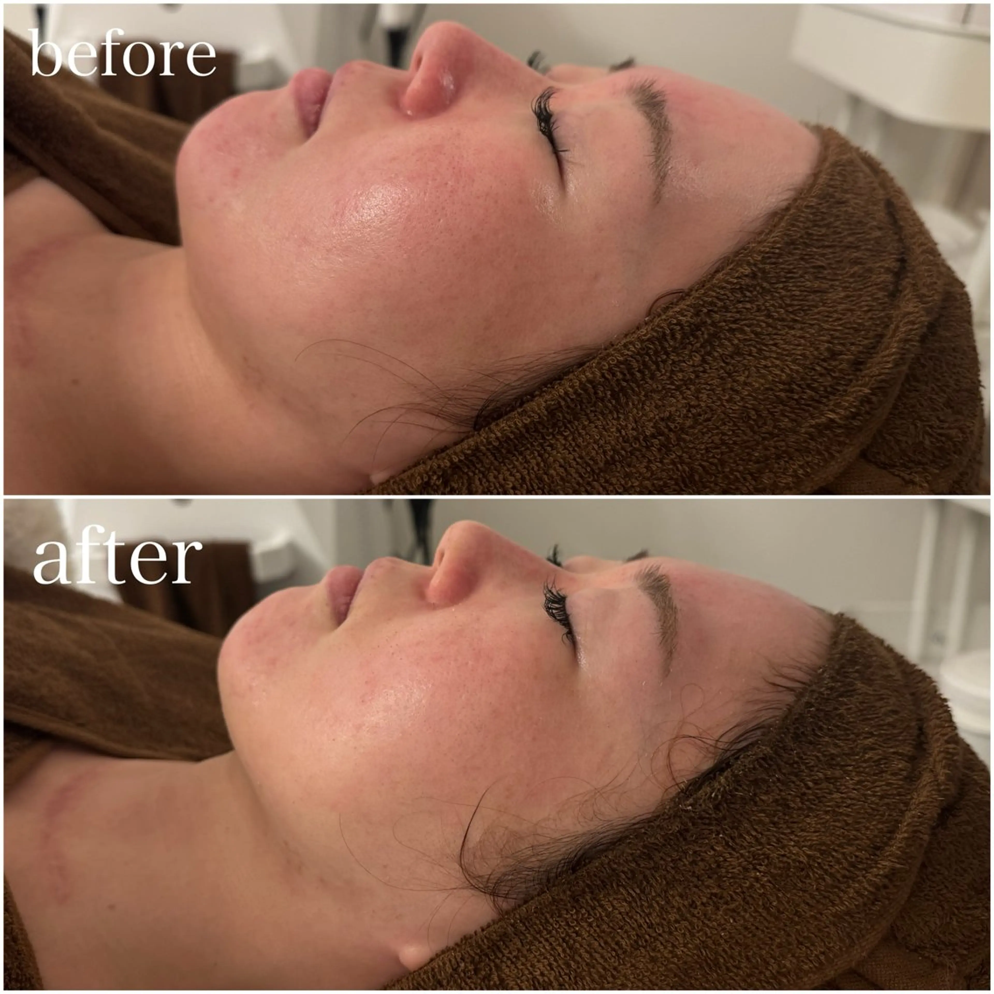 エステ 23beauty所属・武藤 那月のエステ・リラクイメージ