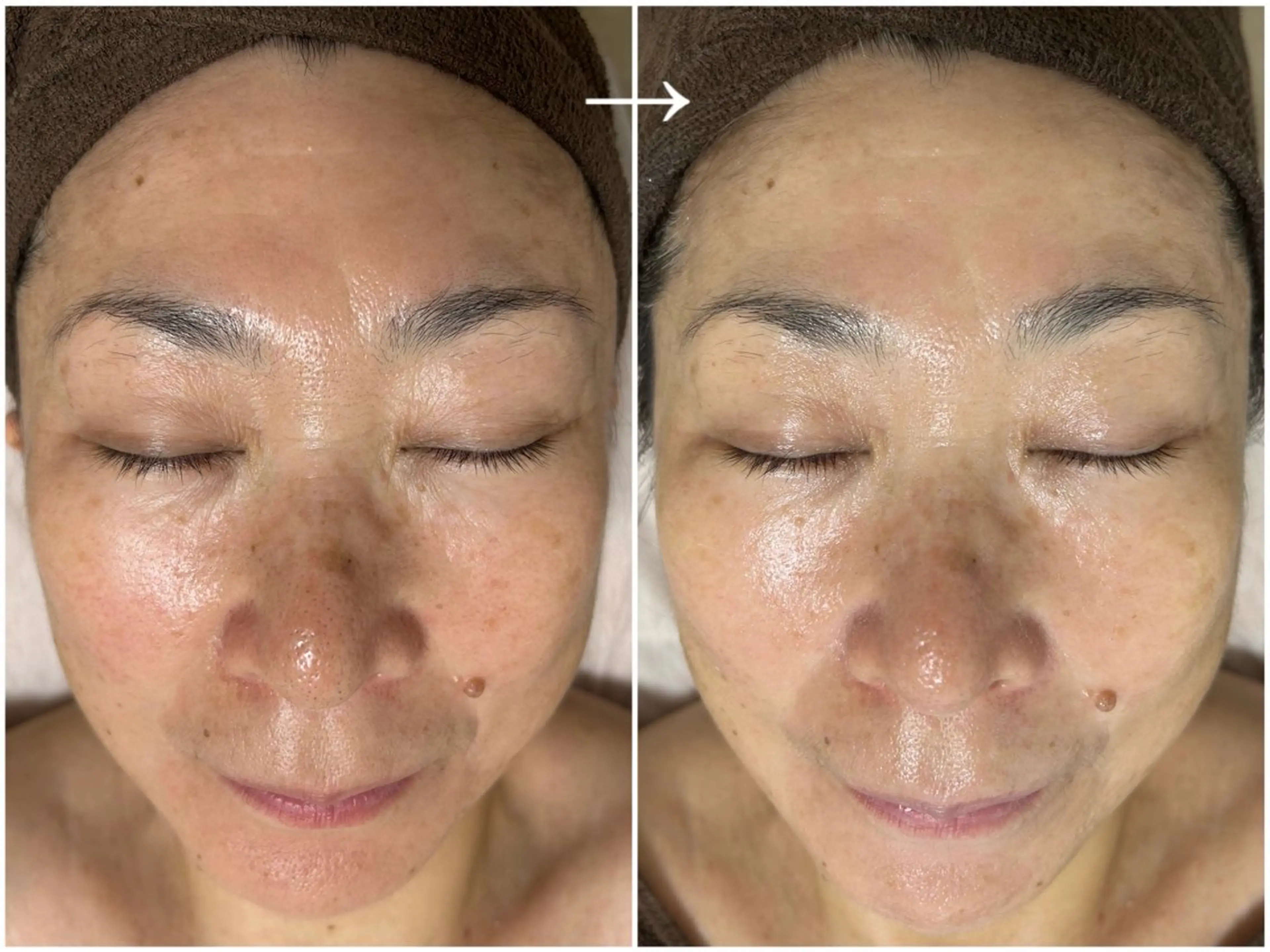 デアイム高島平所属・兼松 美香のエステ・リラクイメージ