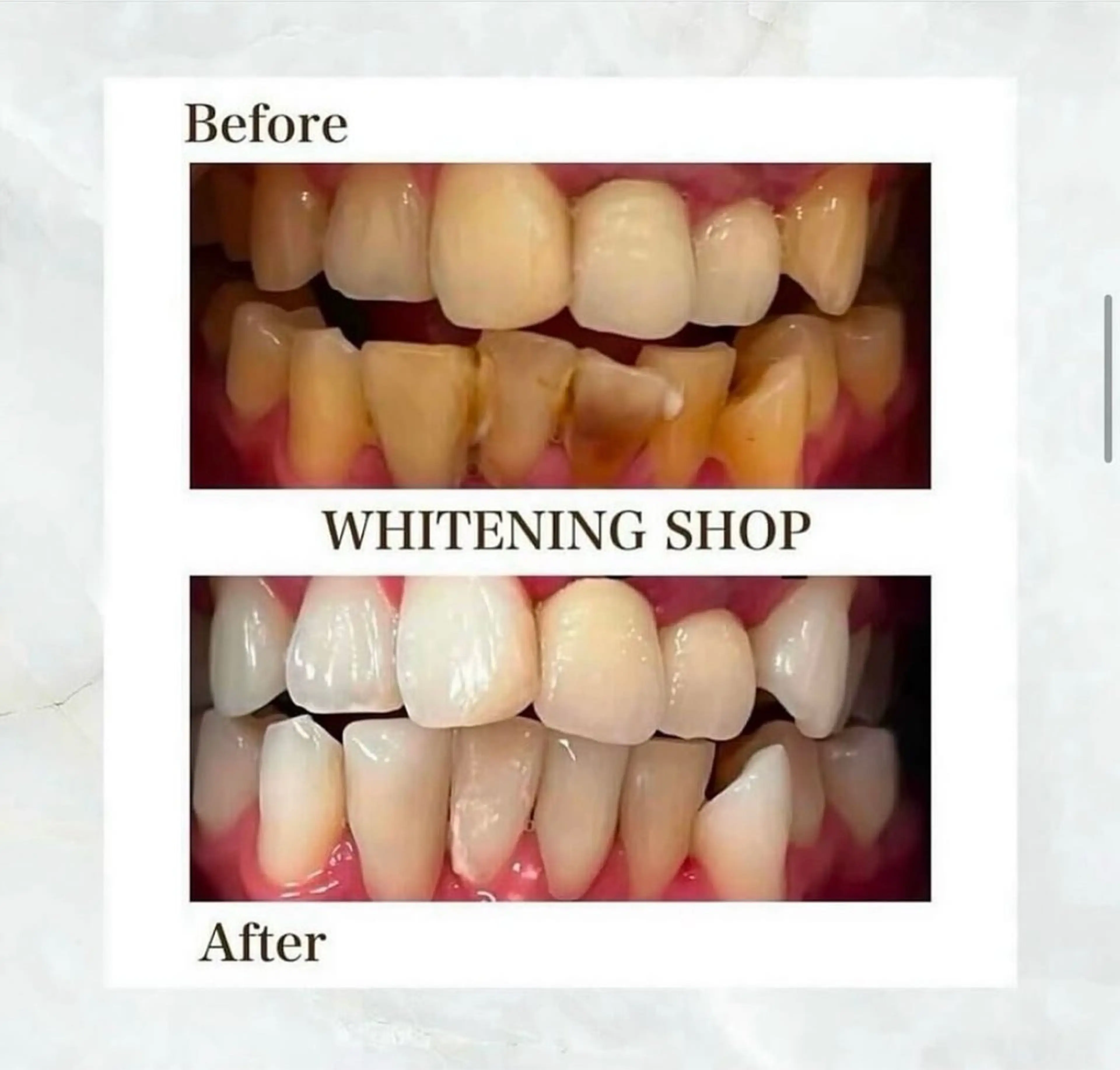 ホワイトニングショップ伊丹店所属・ホワイトニング ショップ伊丹店のその他イメージ