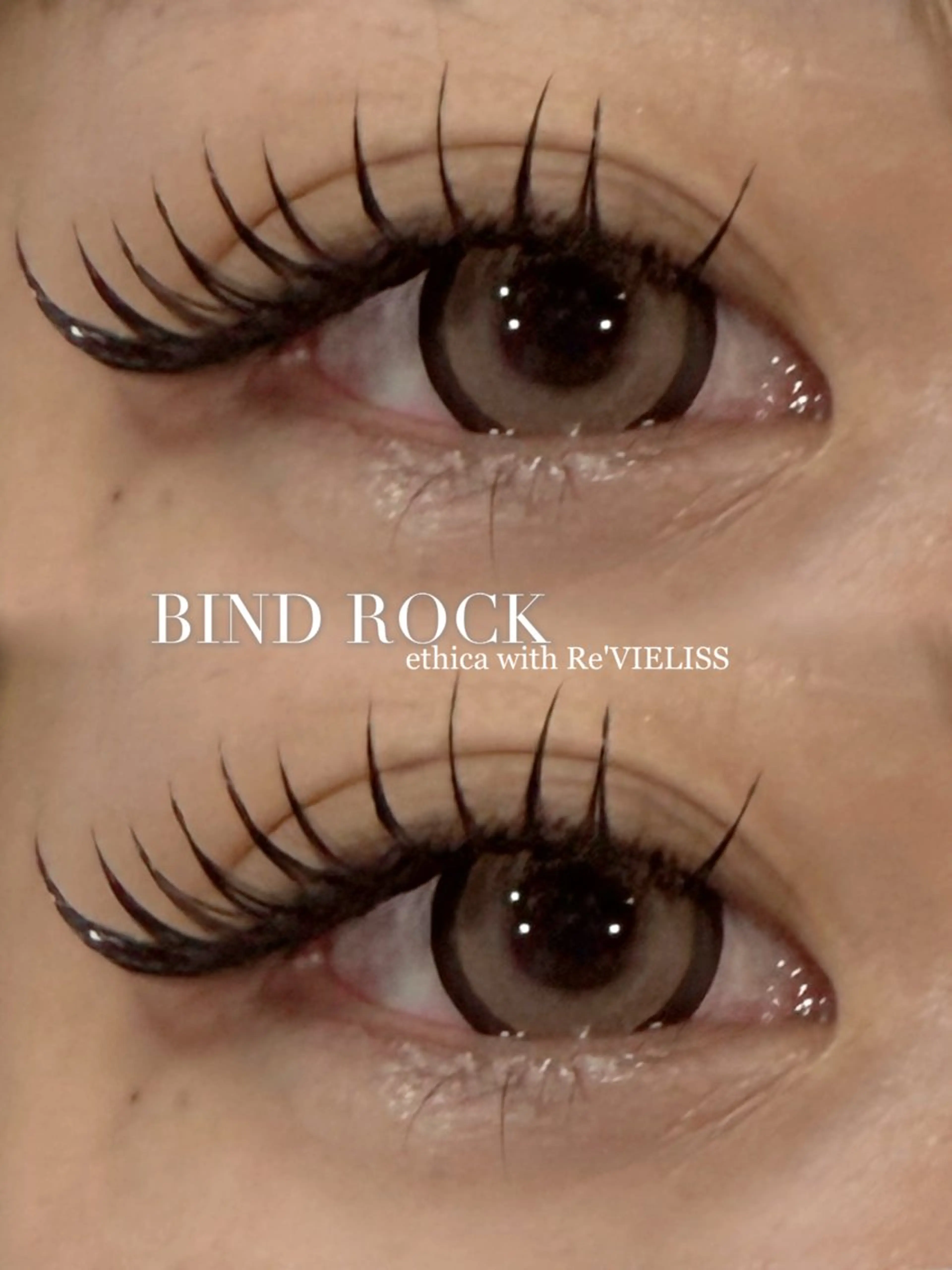 バインドロック140束(560本相当)の写真