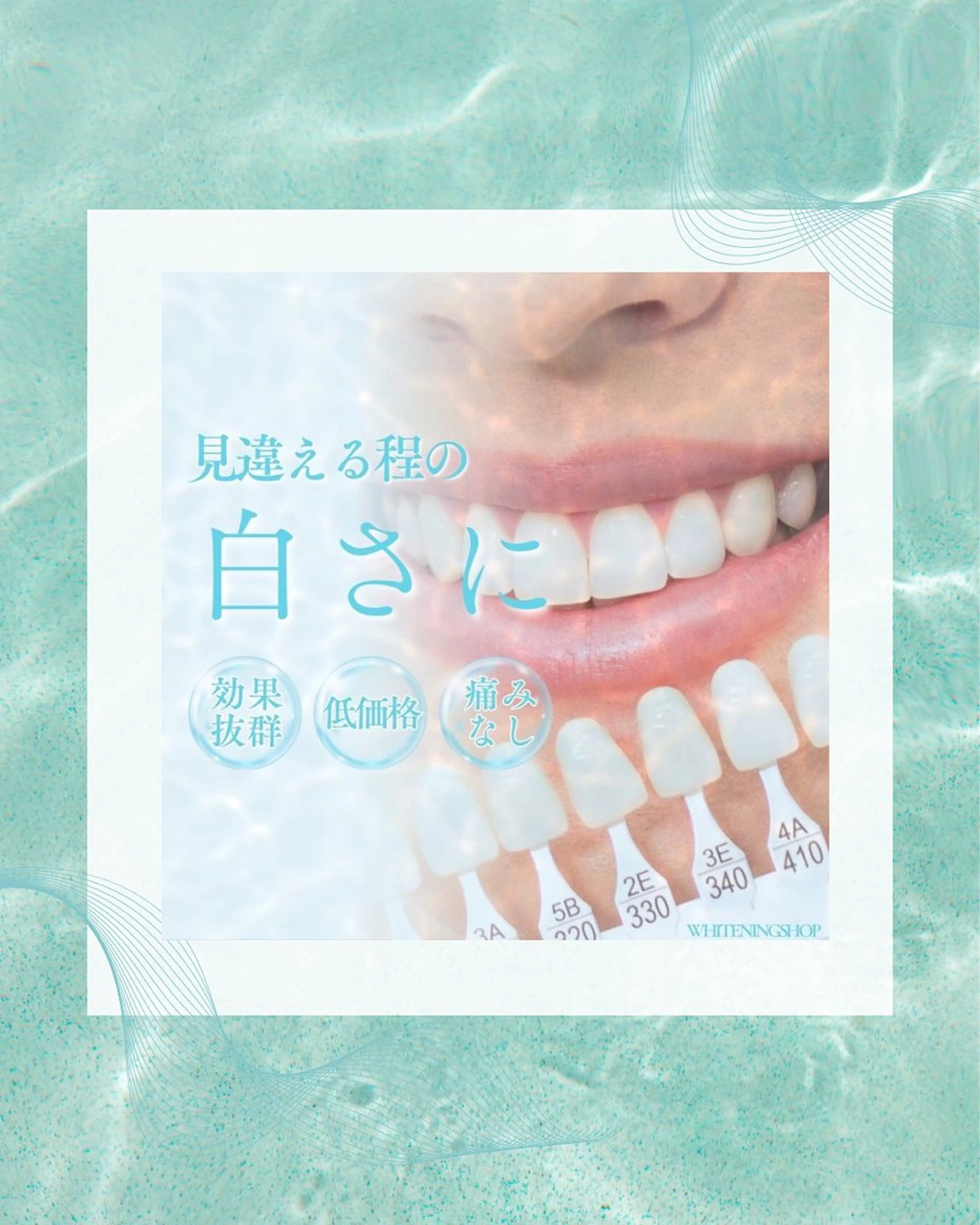 ホワイトニングショップ静岡葵区店所属・ホワイトニング ショップ葵区静岡駅店のその他イメージ