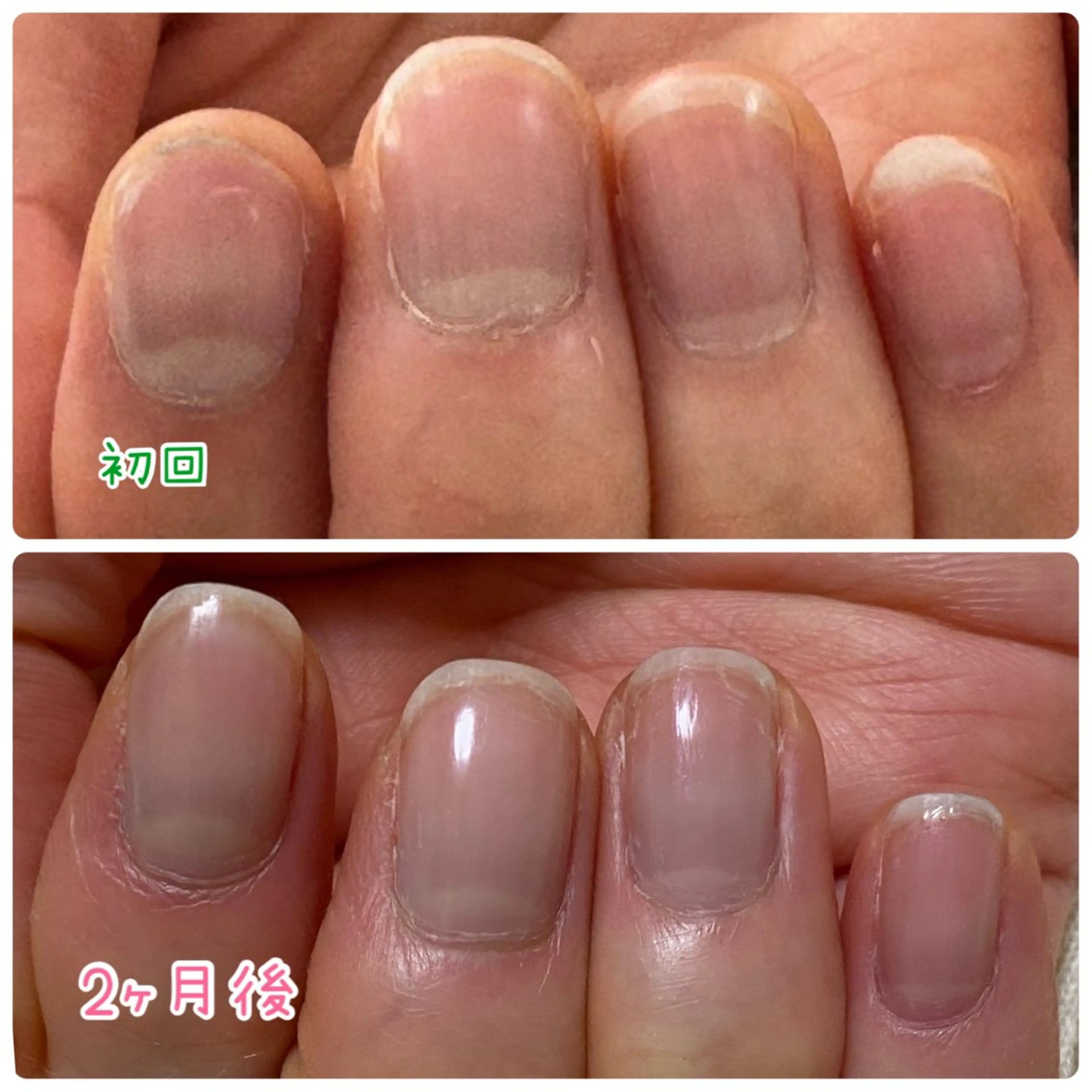 ネイル その他(ネイル) Ella nailsalon所属・Ella nail ちゆうのネイルデザイン