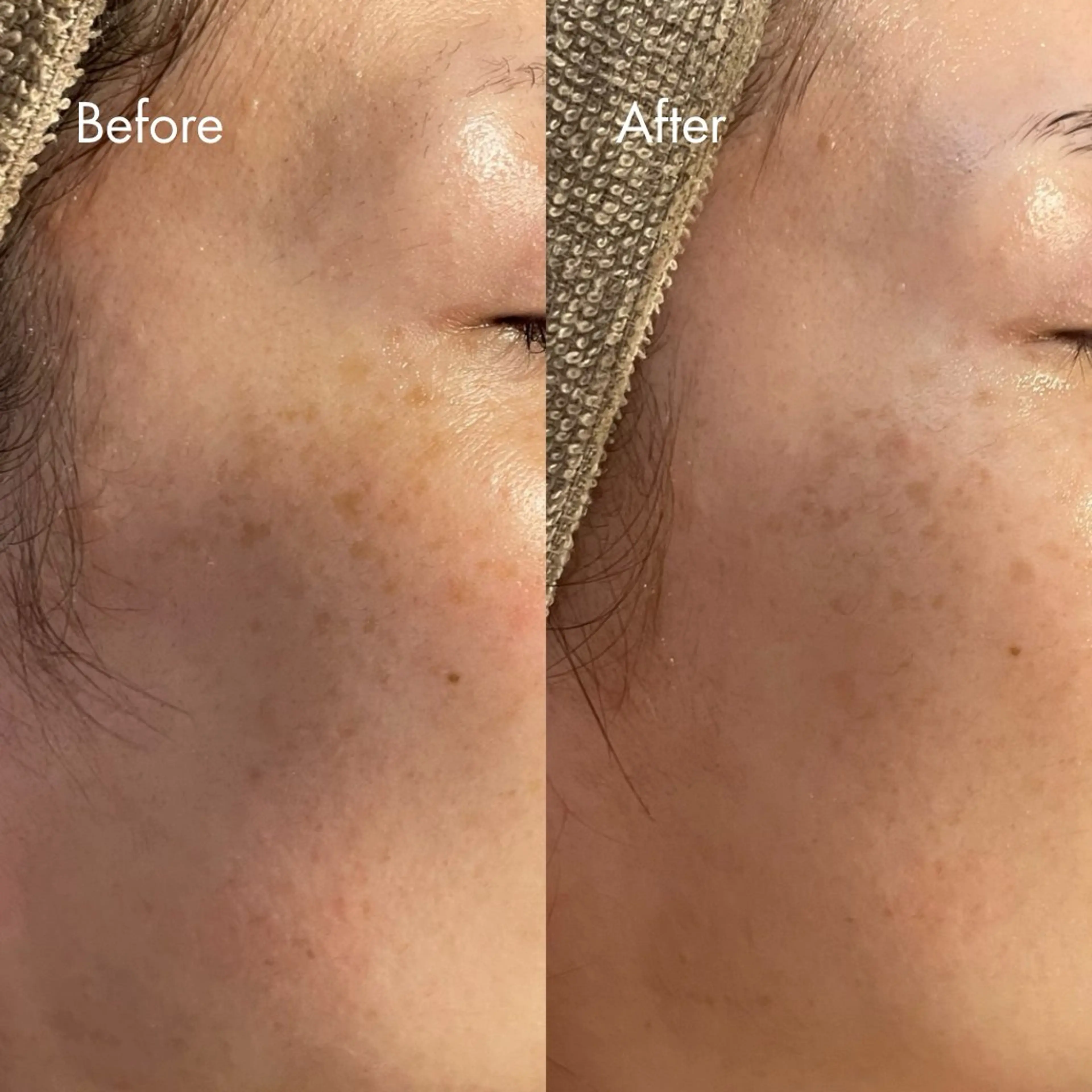 エステ Lassy Yuriの眉毛・アイブロウイメージ