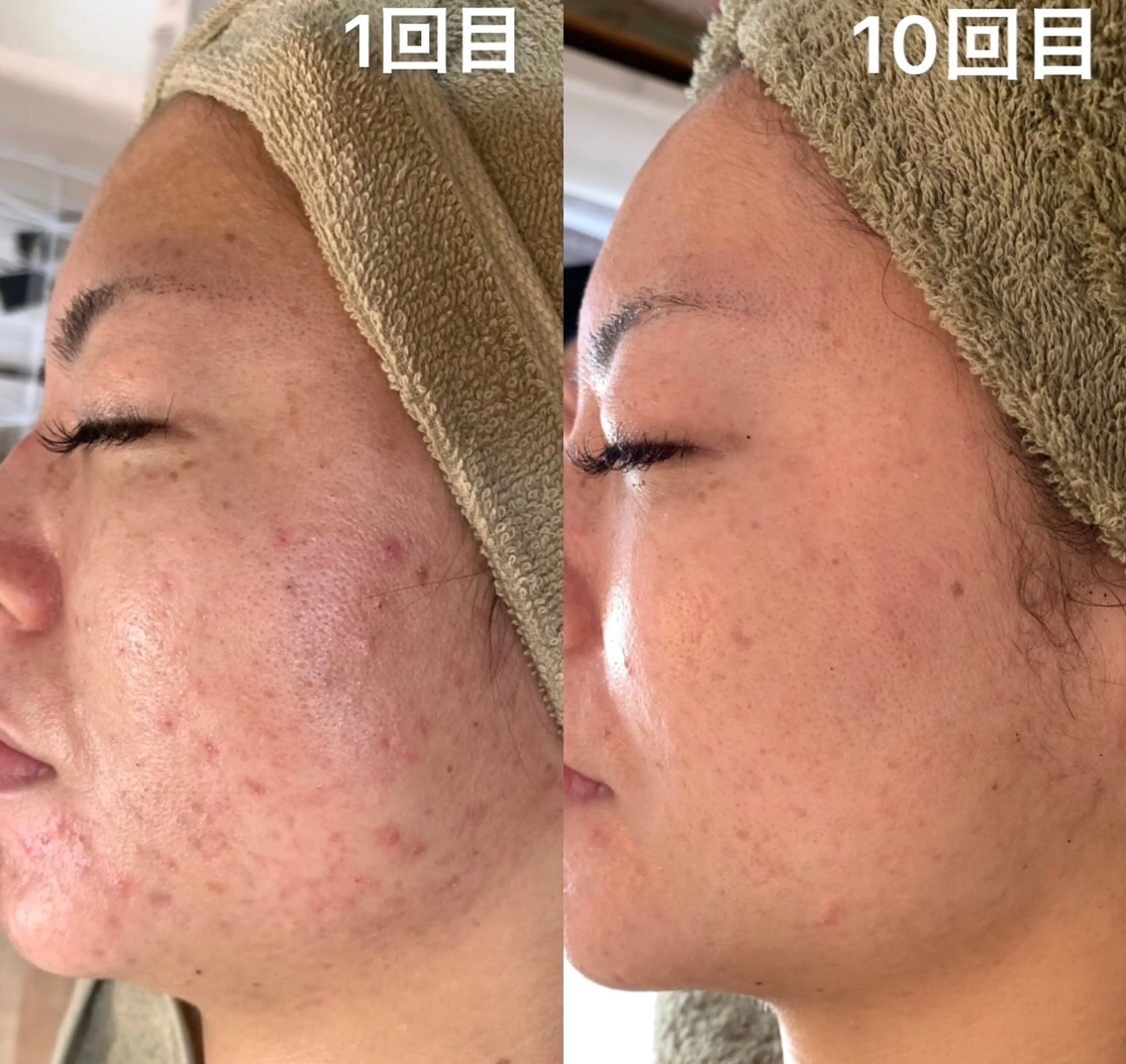 🆕✨　𝑬𝑹𝑰 南大塚の美肌改善のエステ・リラクイメージ