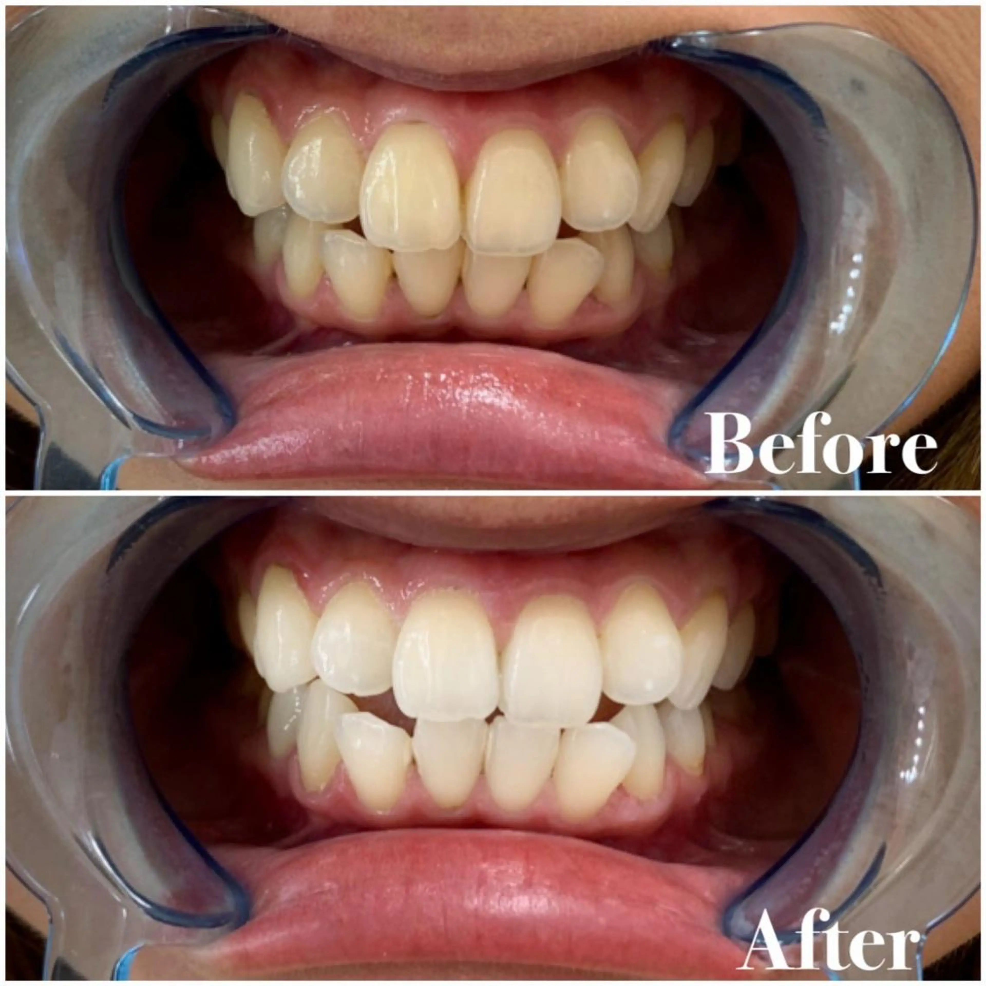 ライトビューティー 錦糸町店のエステ・リラクイメージ