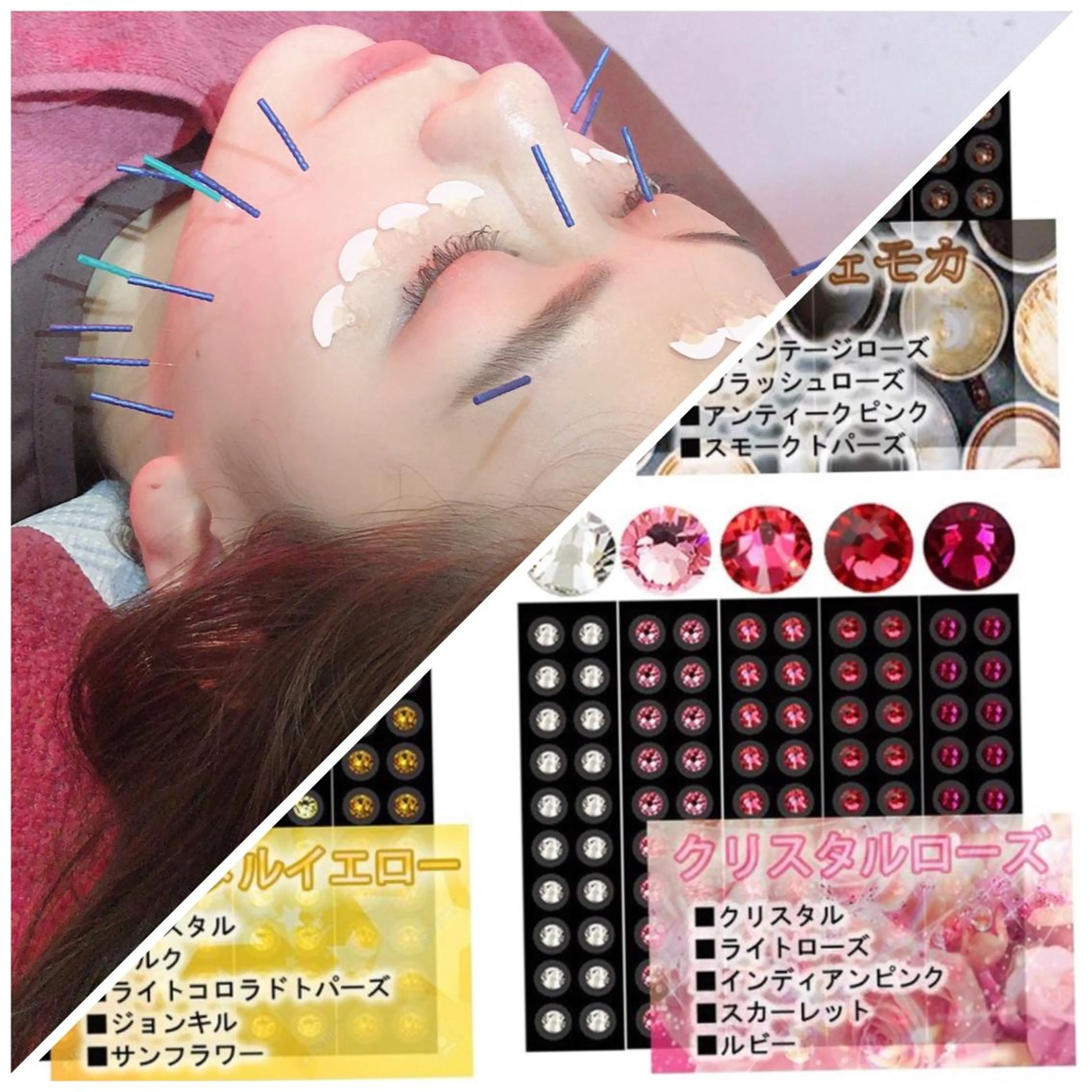 ミニモご予約限定❣️小顔＆ダイエット❤️女優鍼＋耳つぼジュエリーダイエットの写真