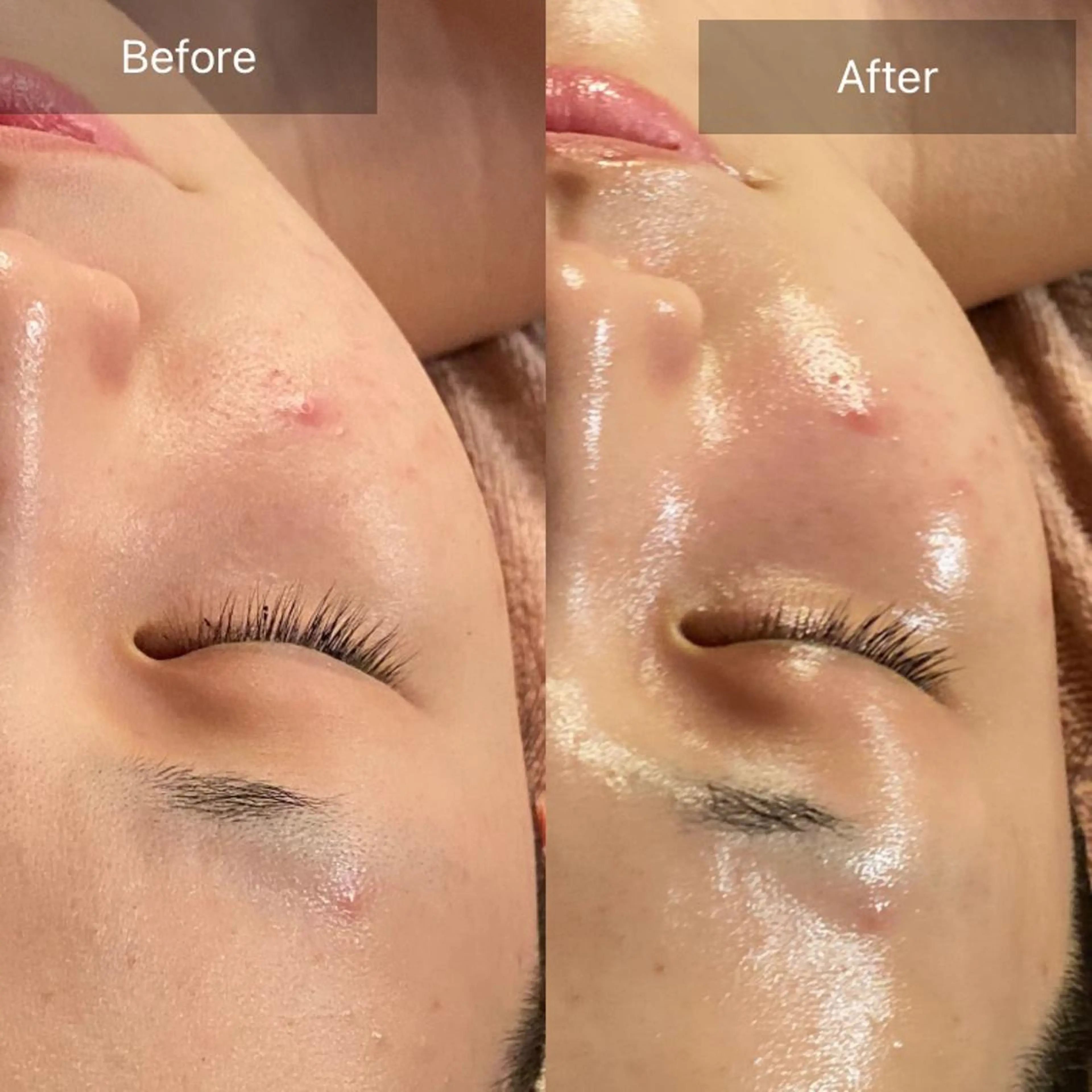 Mandarin Orange所属・毛穴から始める肌メン テマンダリンオレンジのエステ・リラクイメージ