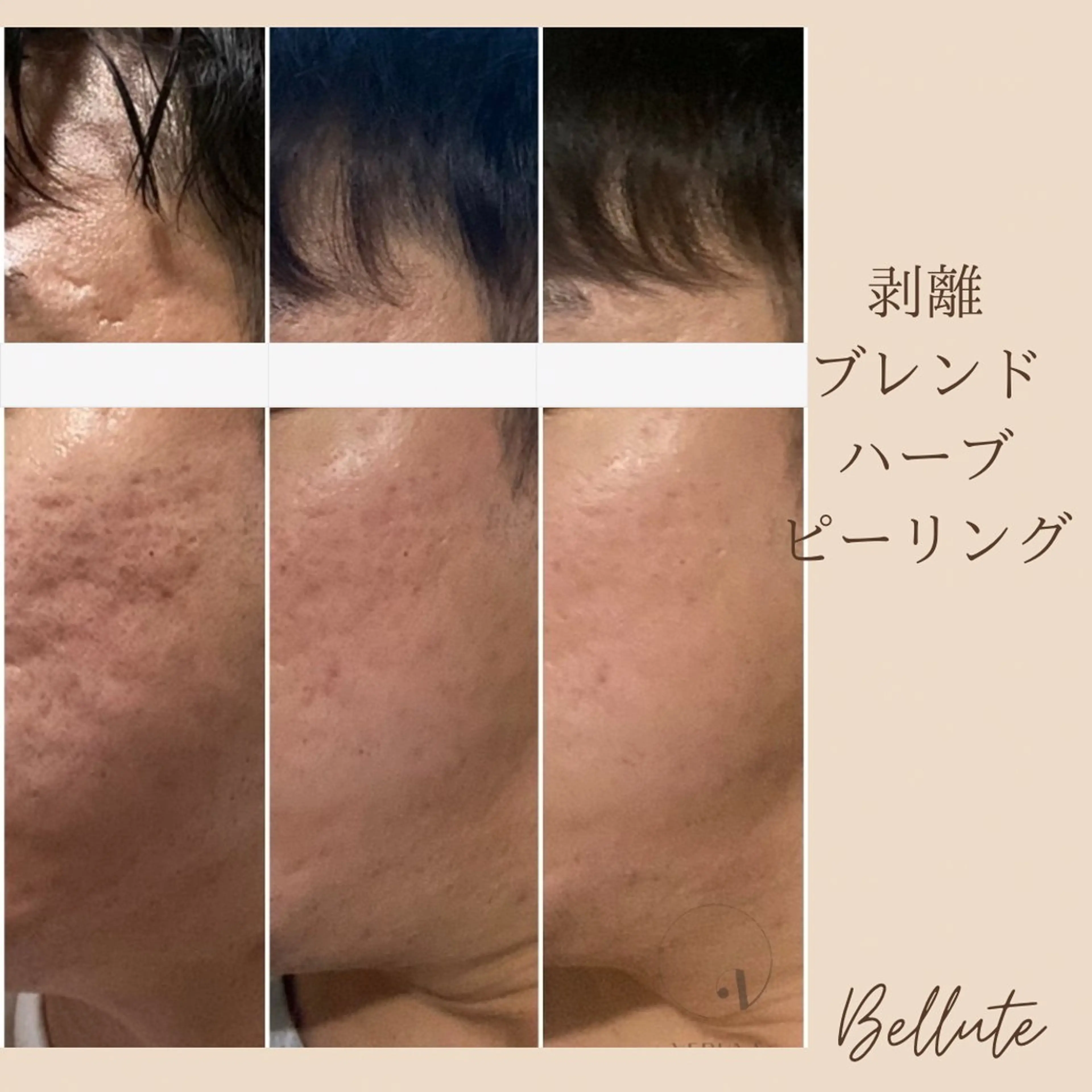 エステ リラク ピーリング専門店 Belluteのエステ・リラクイメージ