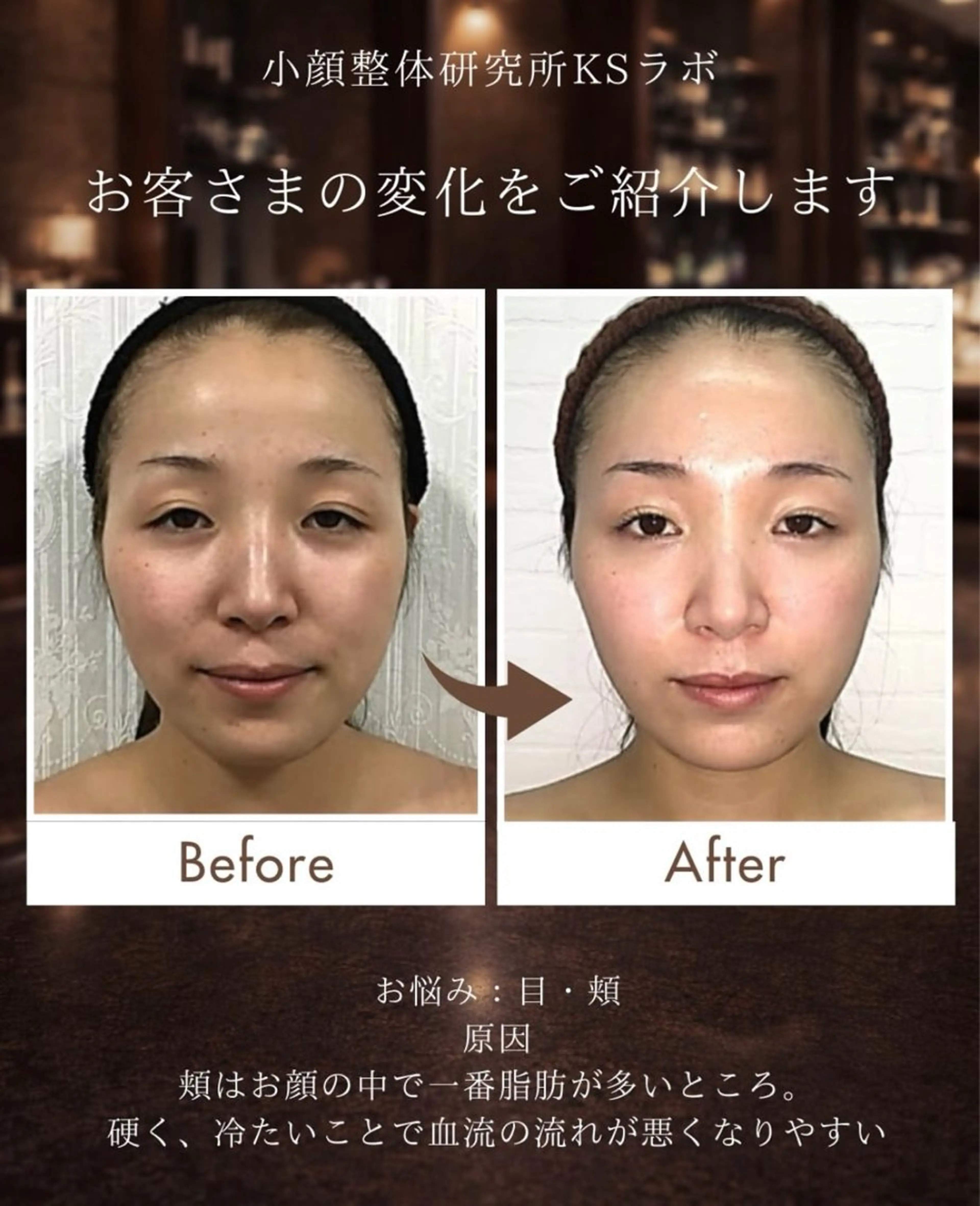 KSラボ自由が丘店所属・小顔整体研究所 KSラボ自由が丘店のエステ・リラクイメージ