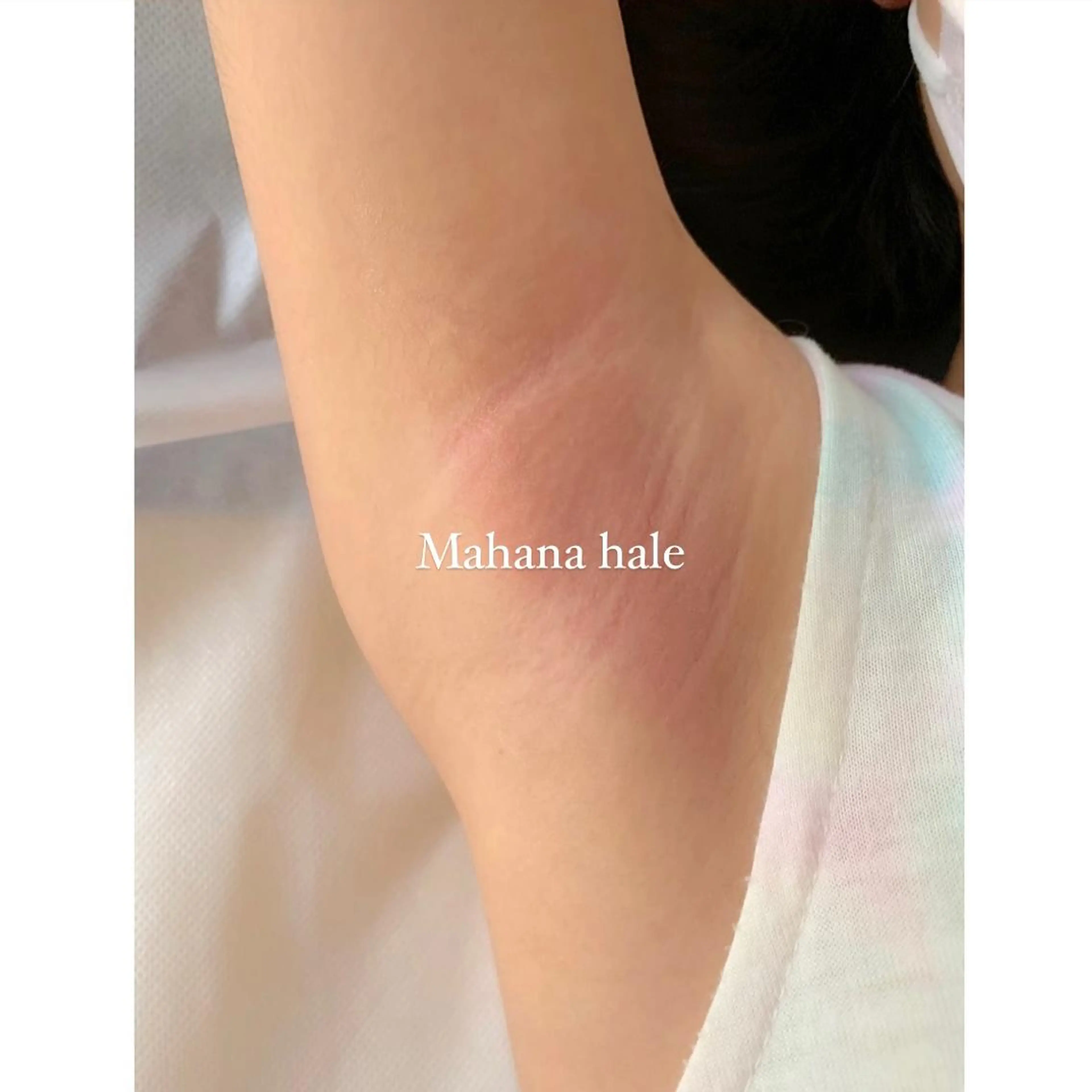 キッズ 脱毛 Mahana hale所属・Mahana haleのエステ・リラクイメージ