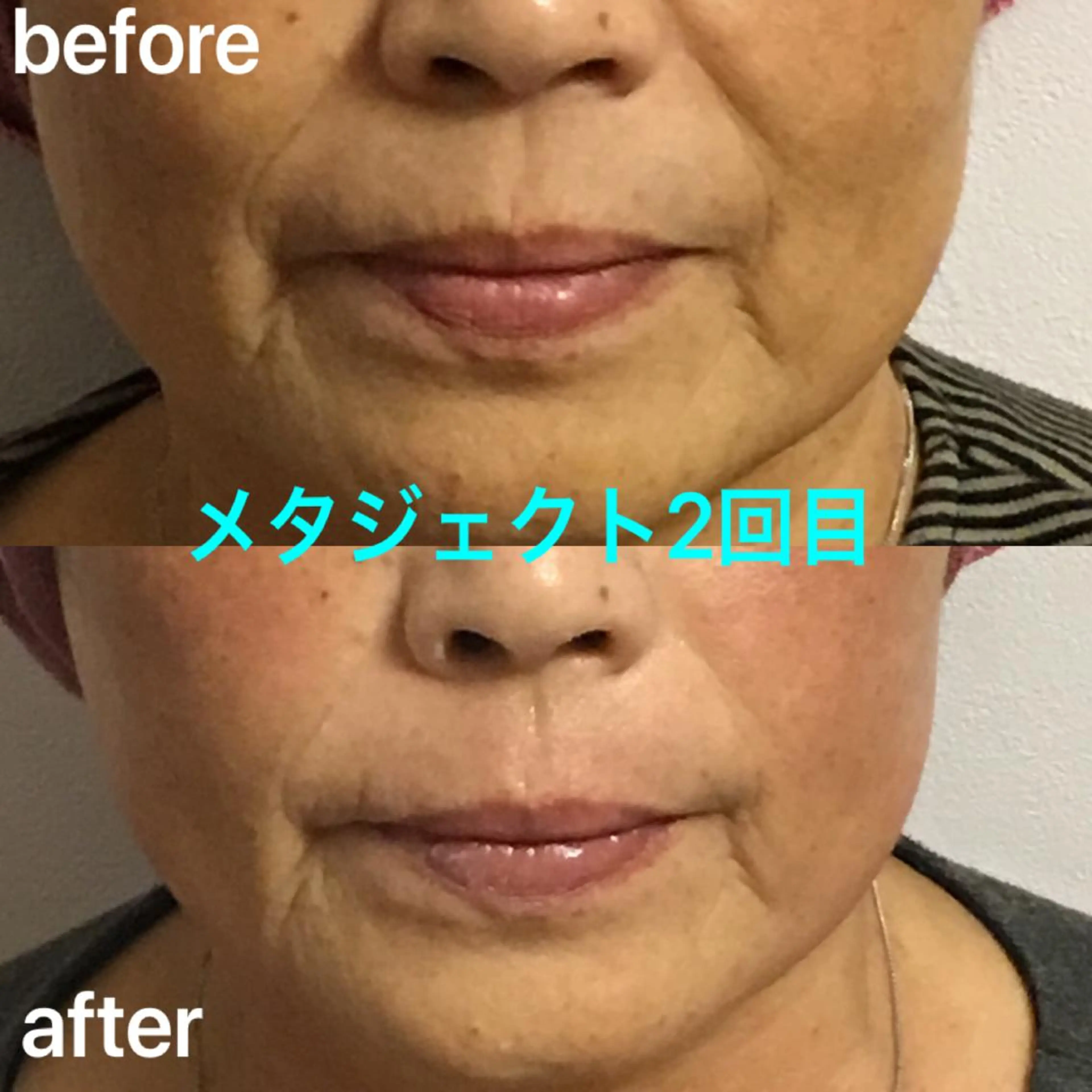 エステ 氣楽所属・松下 さゆりのエステ・リラクイメージ