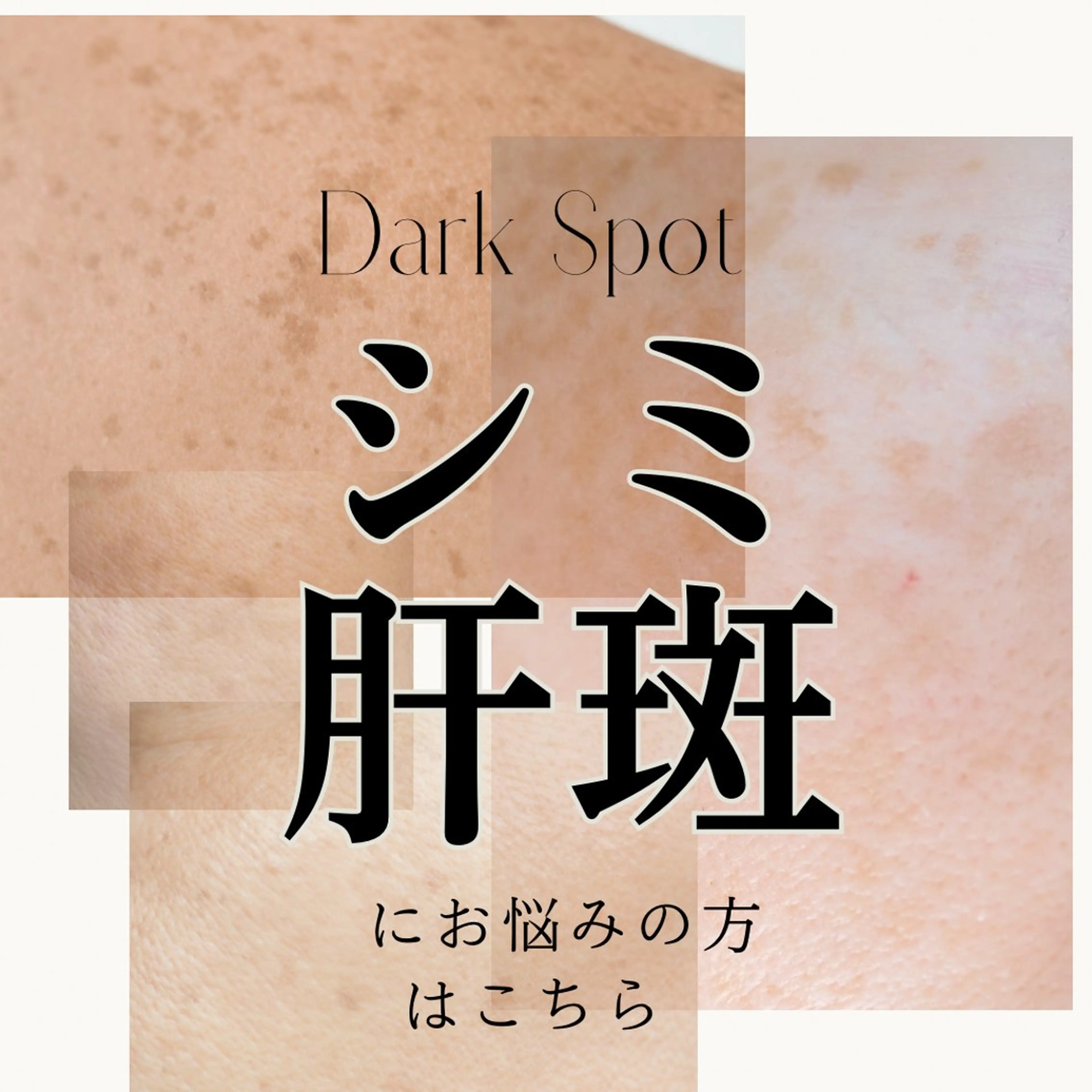 お試し⚠️プレミアムシミ改善👑シミ3​〜​5個/プラズマシャワー/水光リフト/選べる美容液1本丸ごと導入の写真