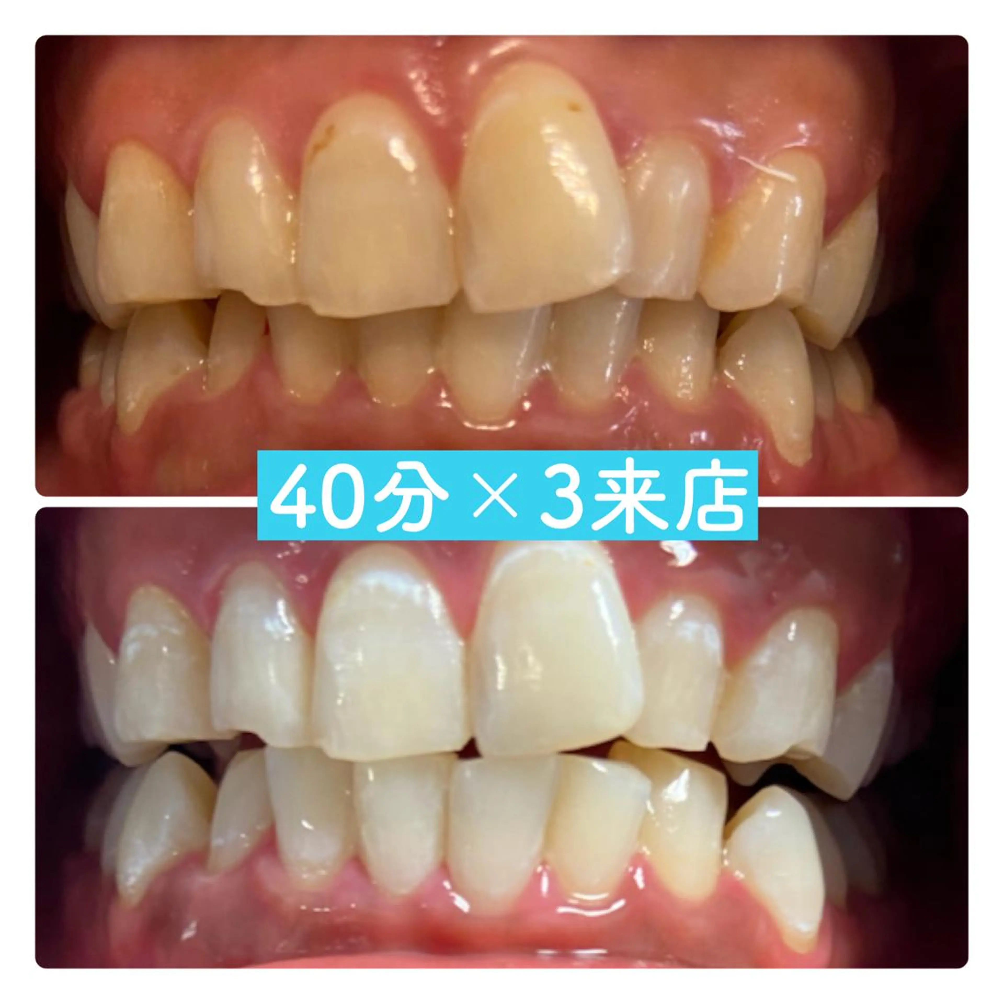 PLATINUM Beauty 横浜店所属・ホワイトニングルーム 横浜店のその他イメージ