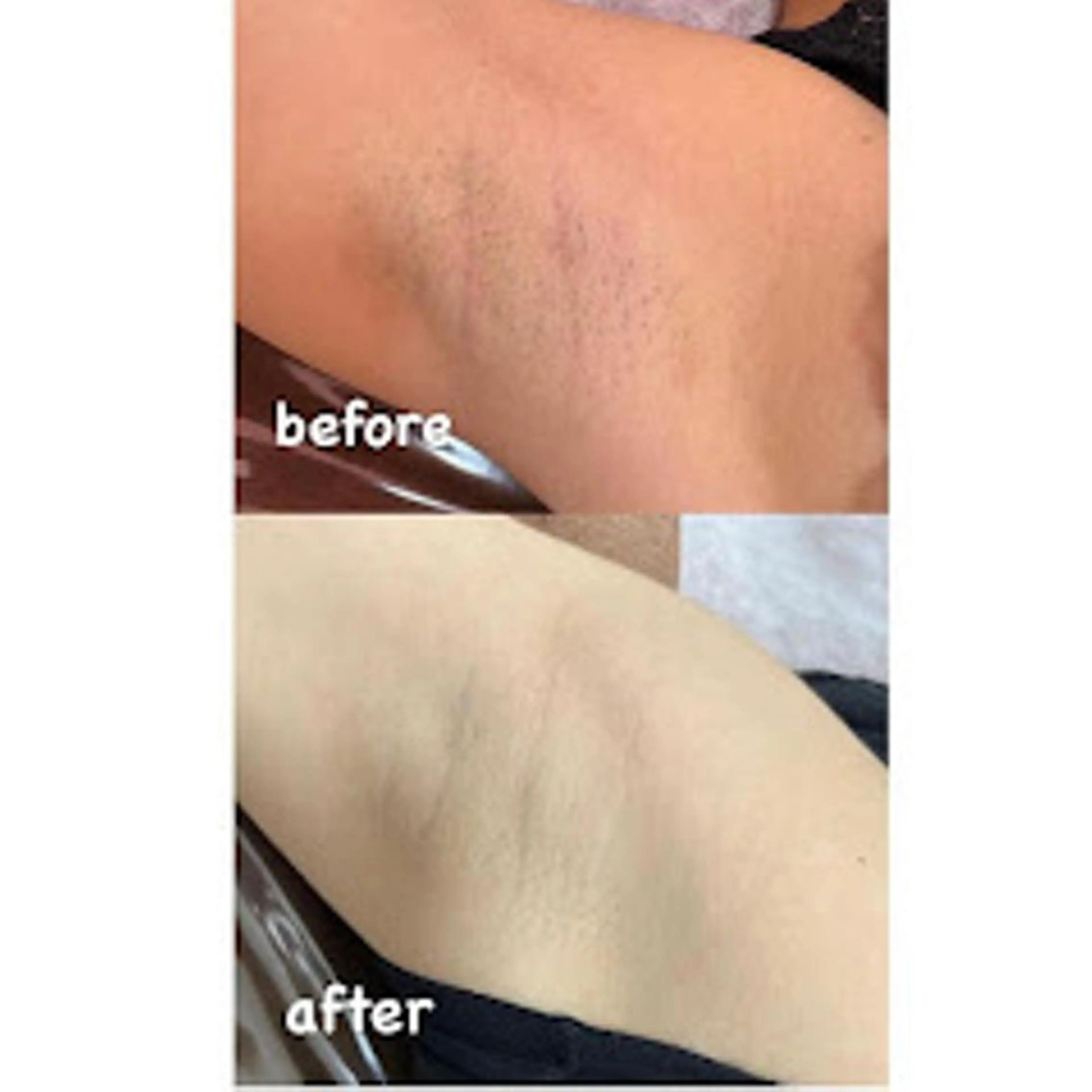 RinRin  津店のエステ・リラクイメージ