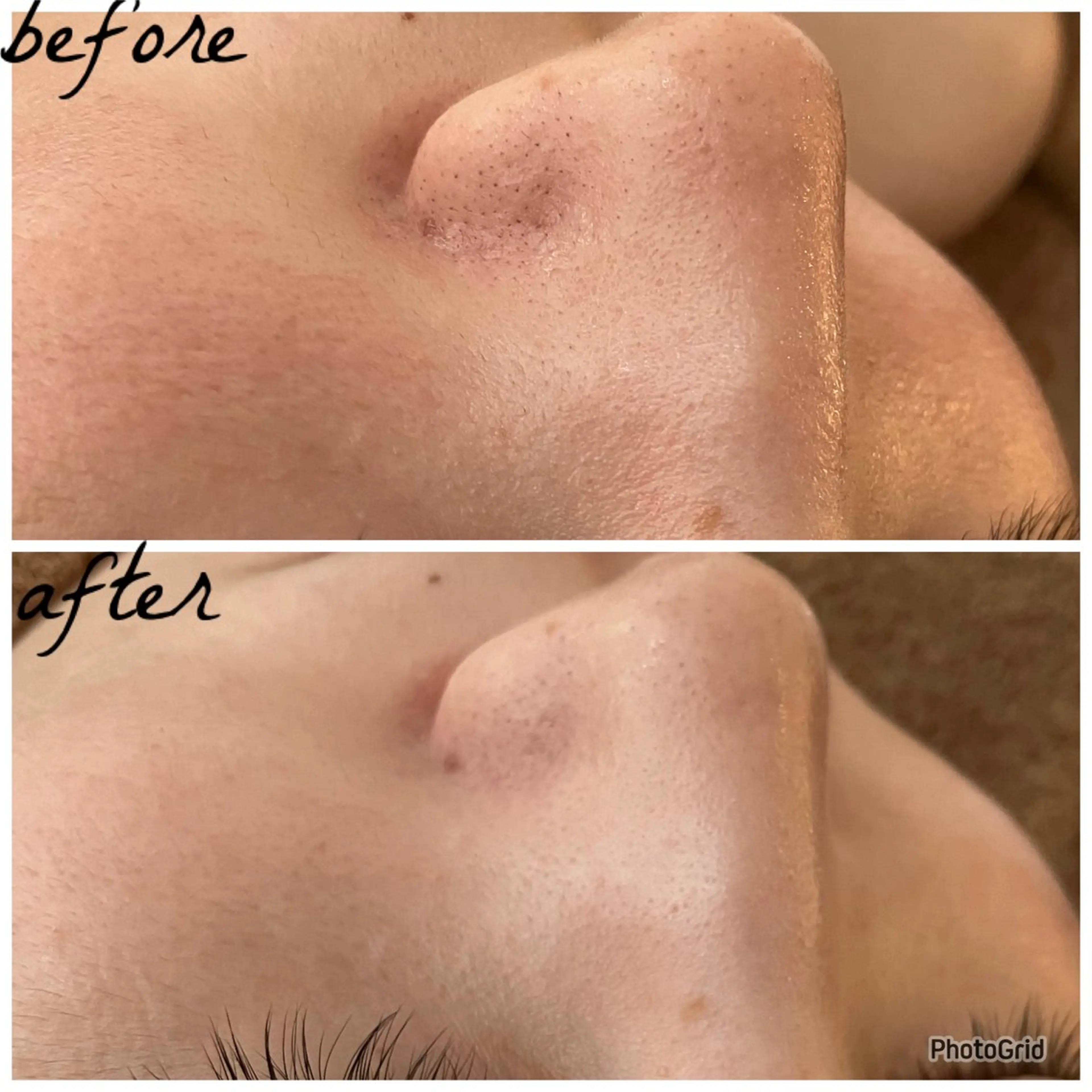 メンズ メナード岐阜茜部 杉浦のエステ・リラクイメージ