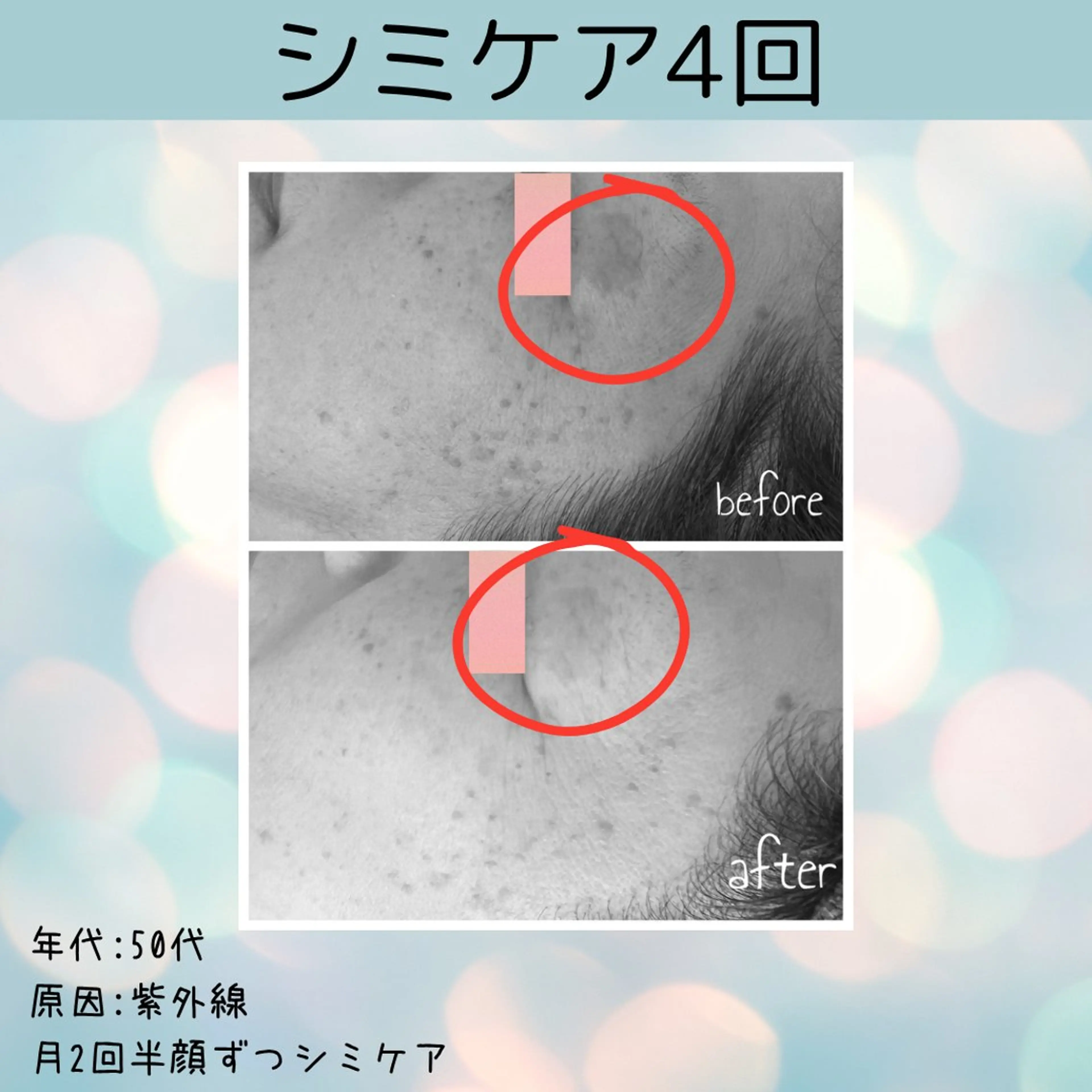 エステ studio acoのエステ・リラクイメージ