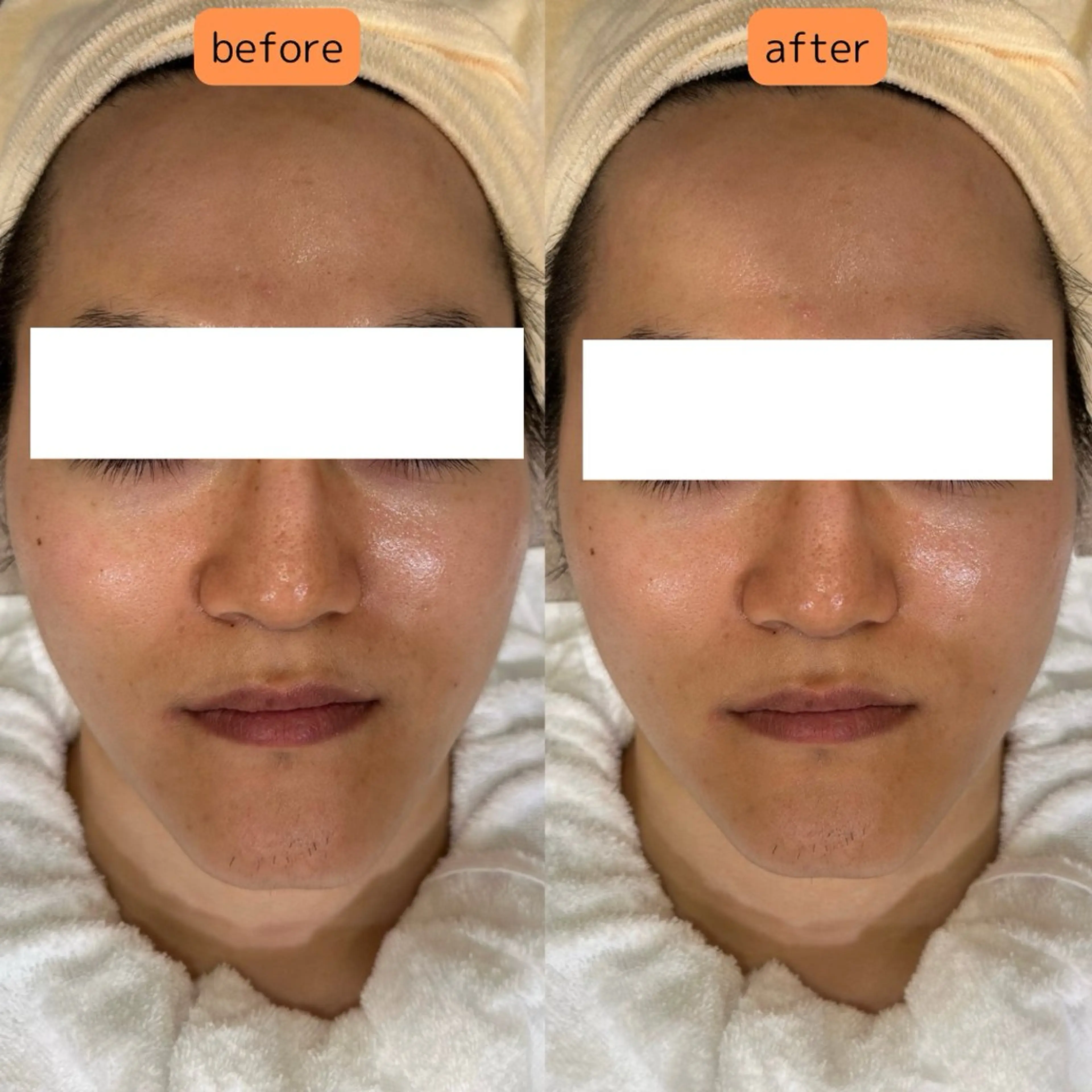 エステ リラク pansy(パンジー)上野フェイシャルエステ専門店所属・pansy saraのエステ・リラクイメージ