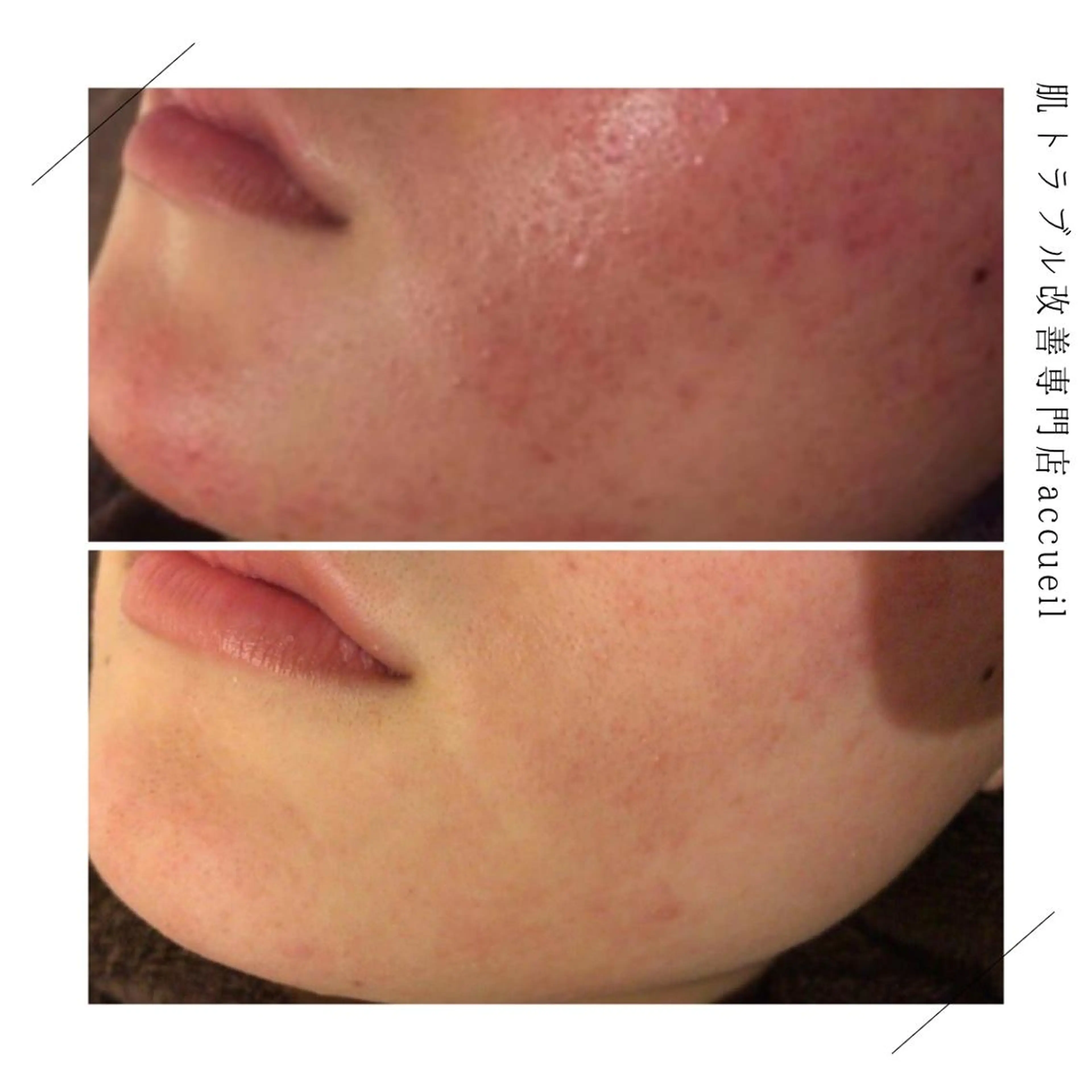 セミロング カラー パーマ ヘアアレンジ メンズ キッズ ネイル マツエク・マツパ アイブロウ 触れたくなる モテ肌へ...❤︎のエステ・リラクイメージ