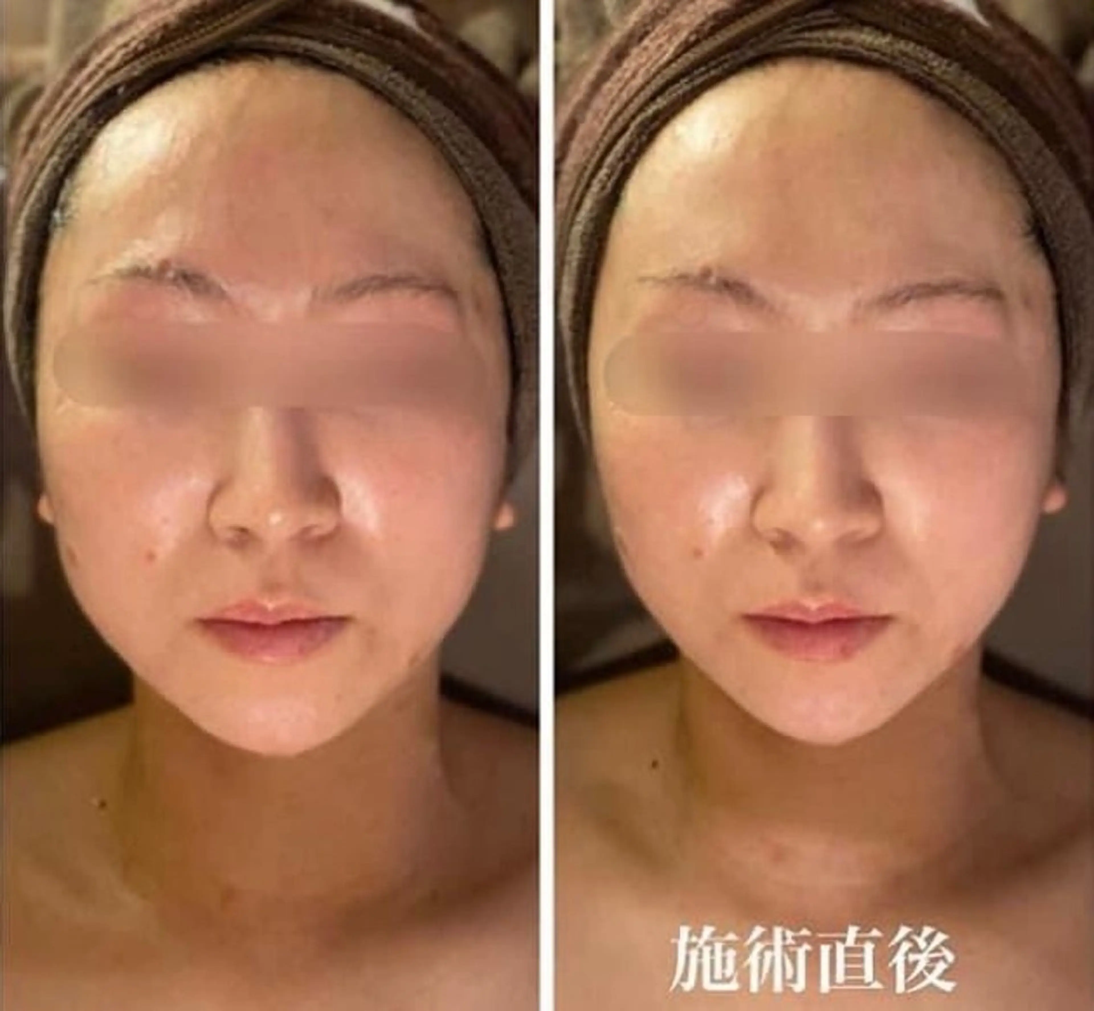 Franc vert ayakoのヘアスタイル