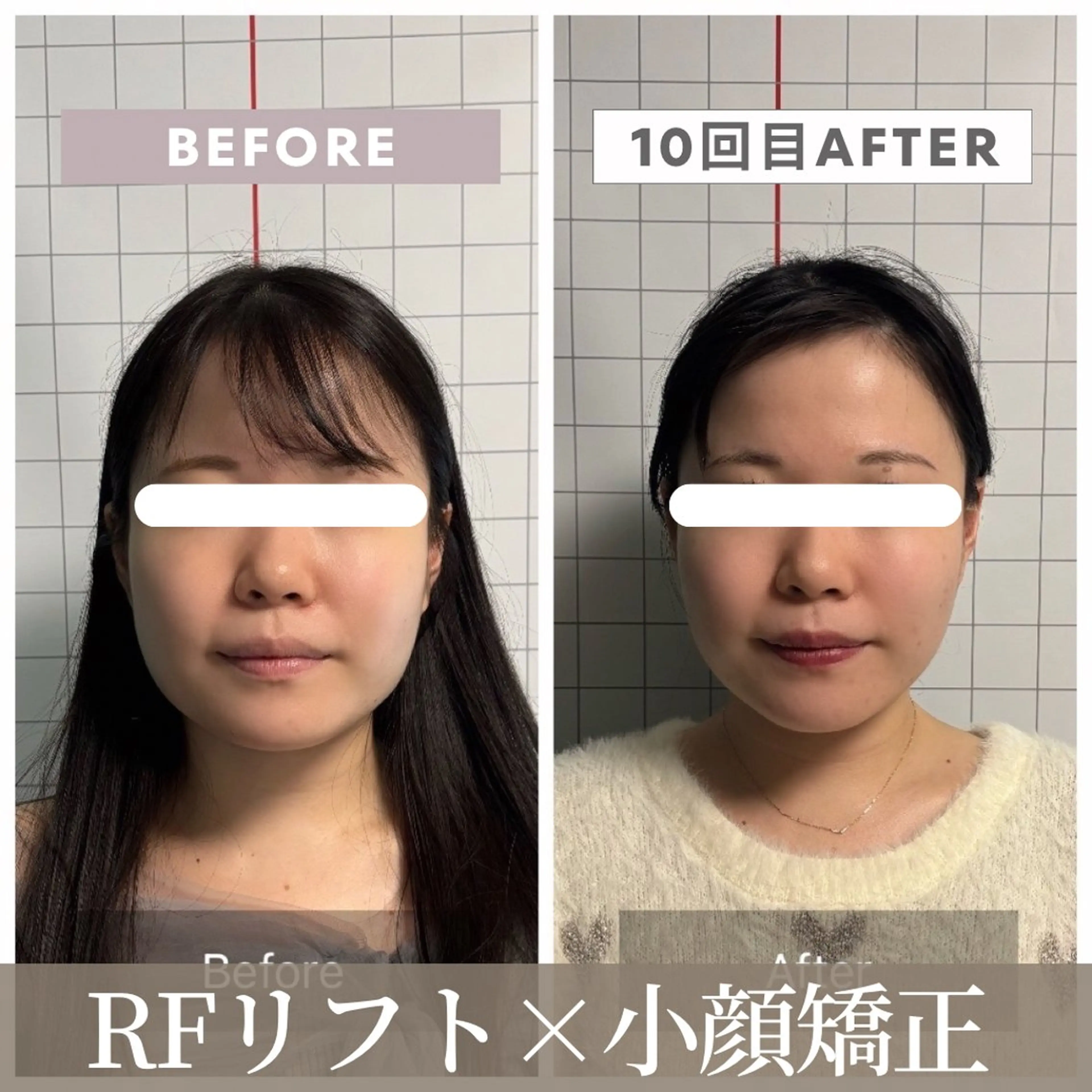 エステ リラク 小顔矯正専門店 【RED】池田のエステ・リラクイメージ