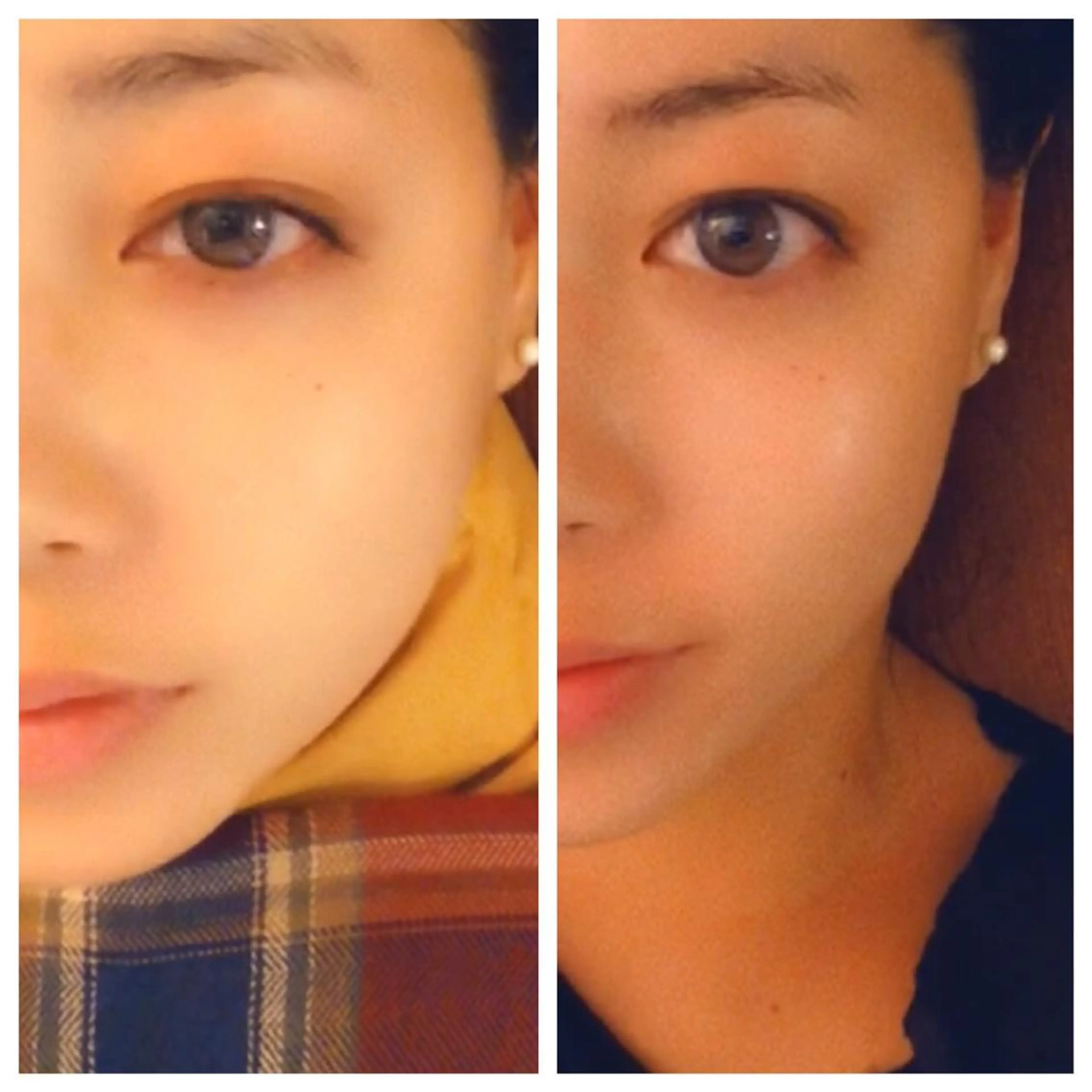 エステ リラク Relama　美容鍼×マッサージ所属・Relama/リラマ 美容鍼×マッサージのエステ・リラクイメージ