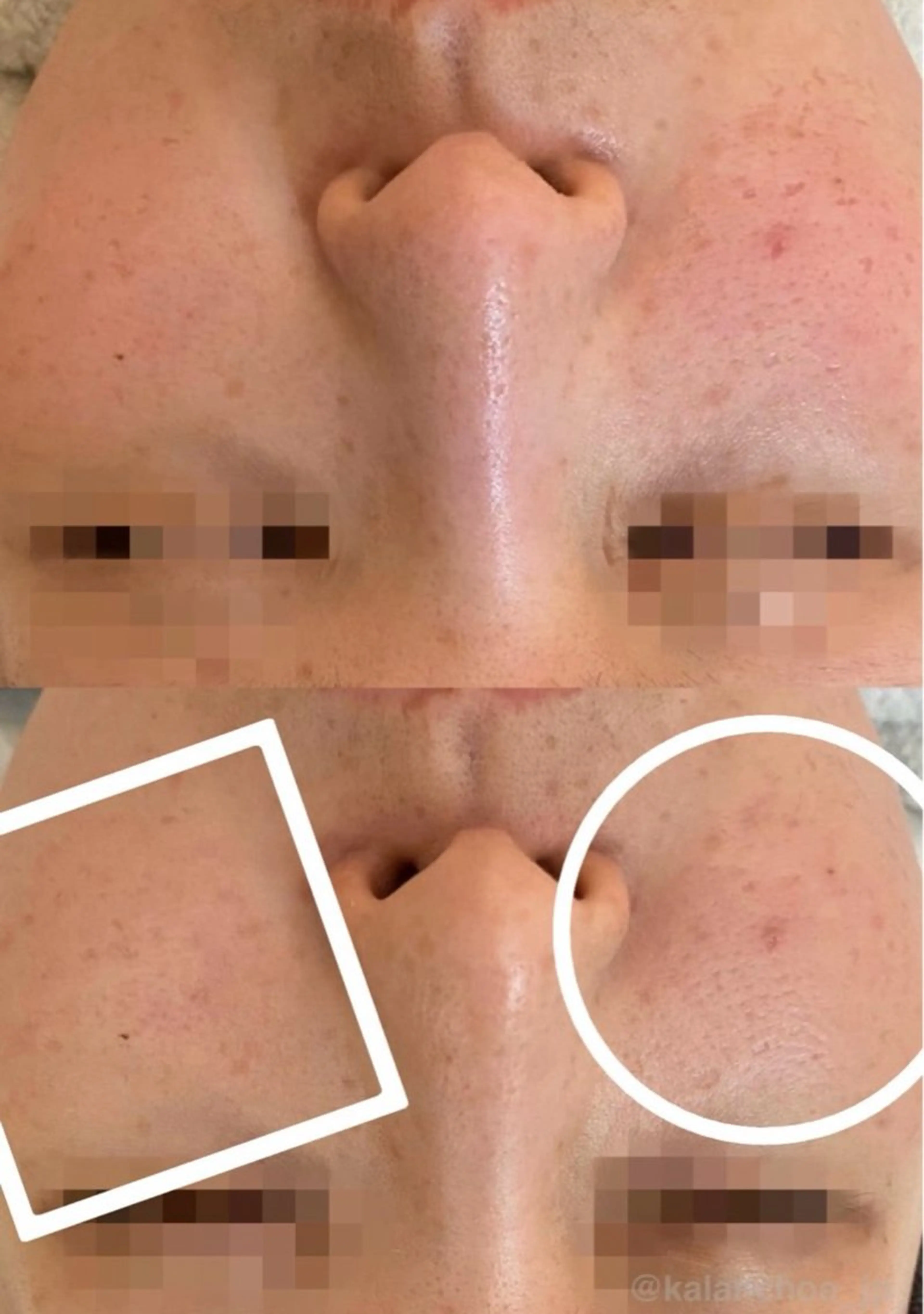 エステ 肌質改善 KALANCHOEのエステ・リラクイメージ