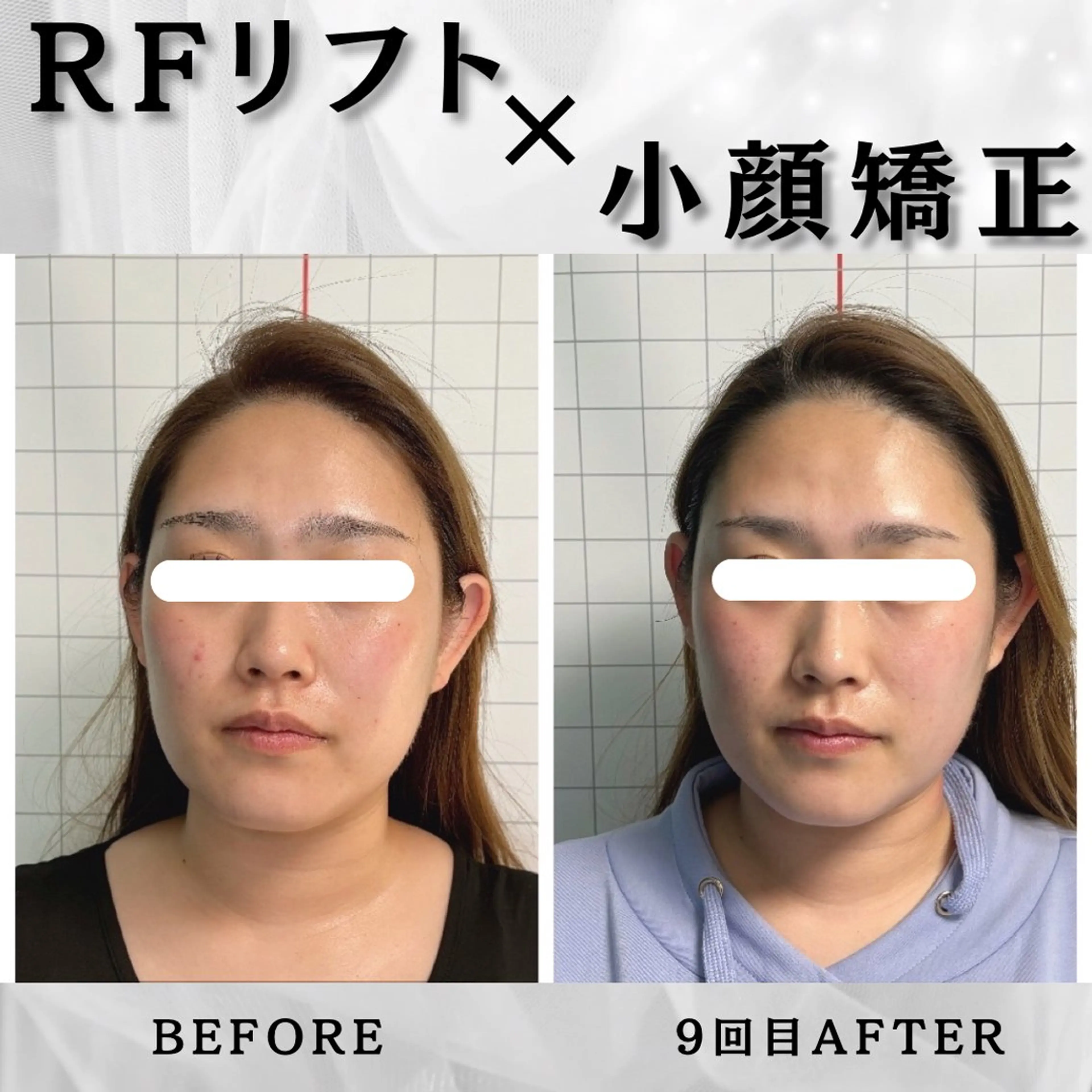 エステ リラク 小顔矯正専門店 【RED】池田のエステ・リラクイメージ