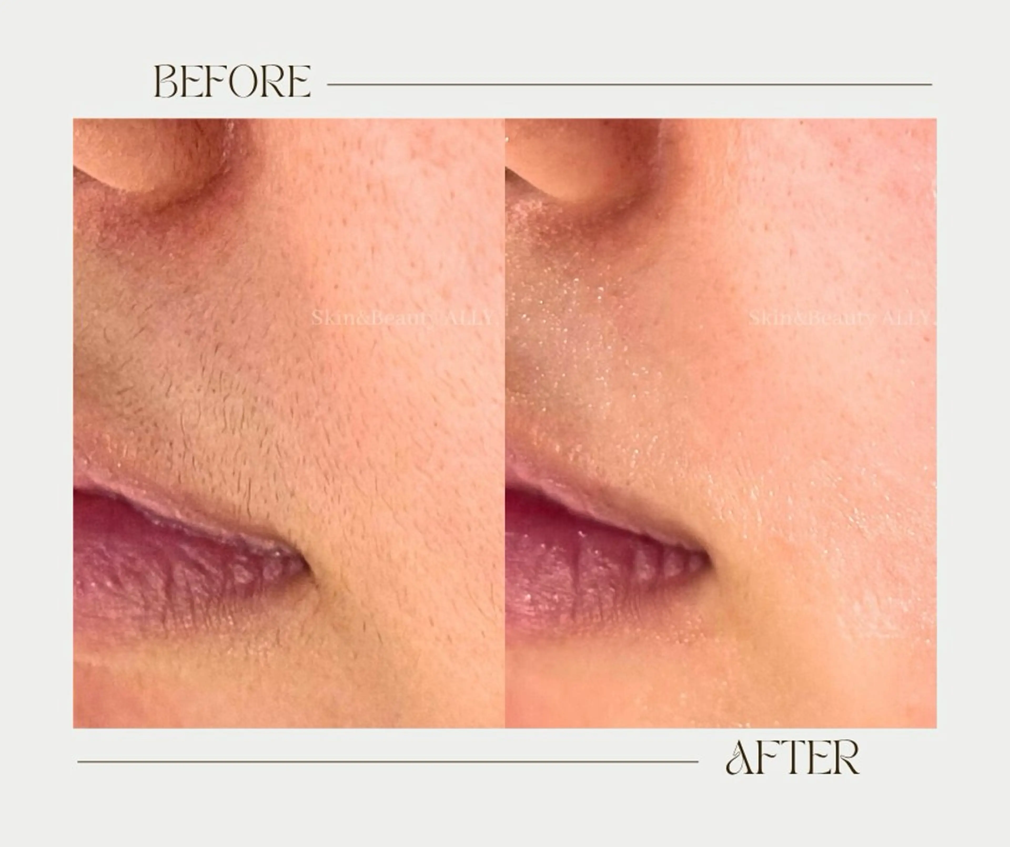 エステ 艶肌ワックス ALLY.のエステ・リラクイメージ