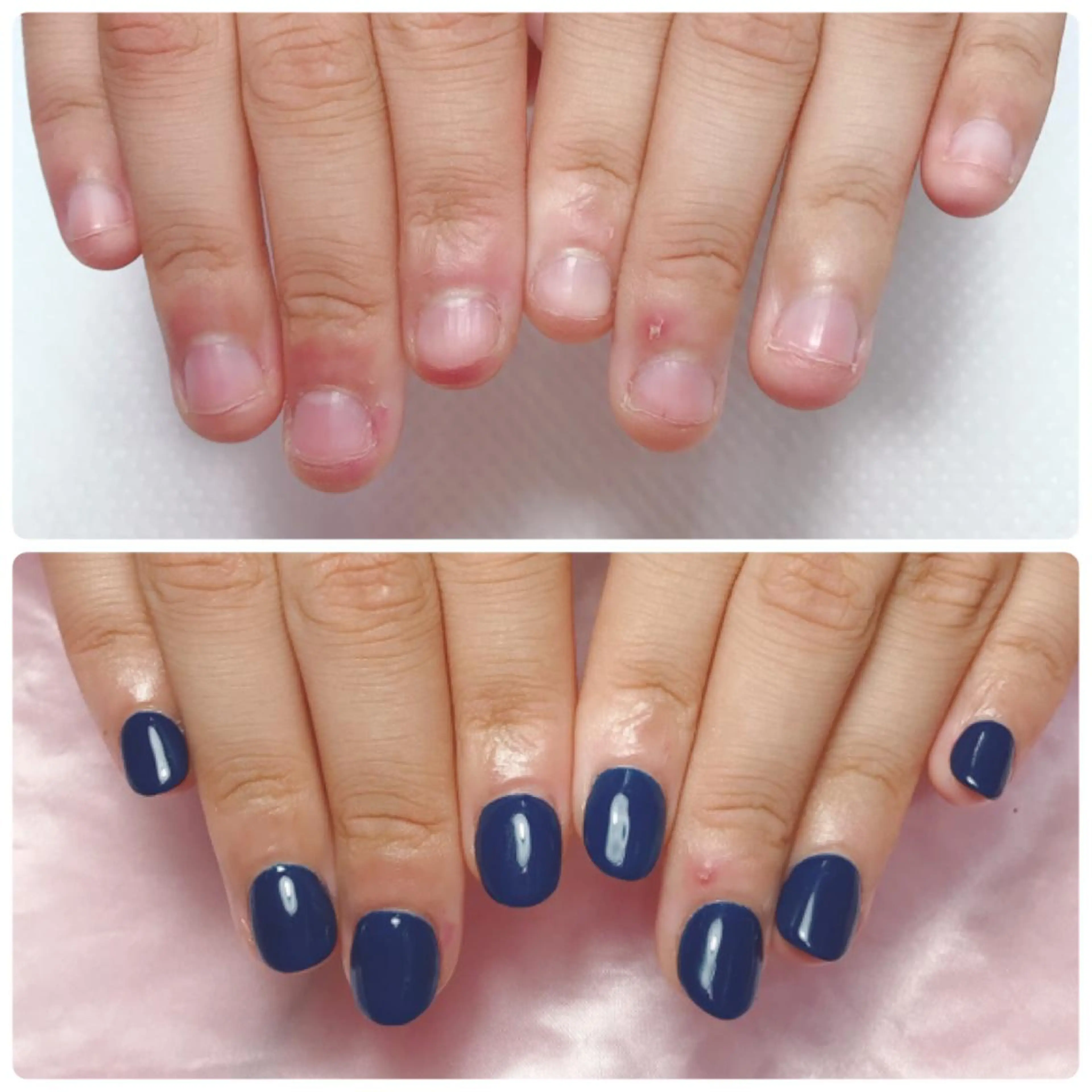 ネイル ハンドネイル 深爪を断らない スカルプ高評価店のネイルデザイン