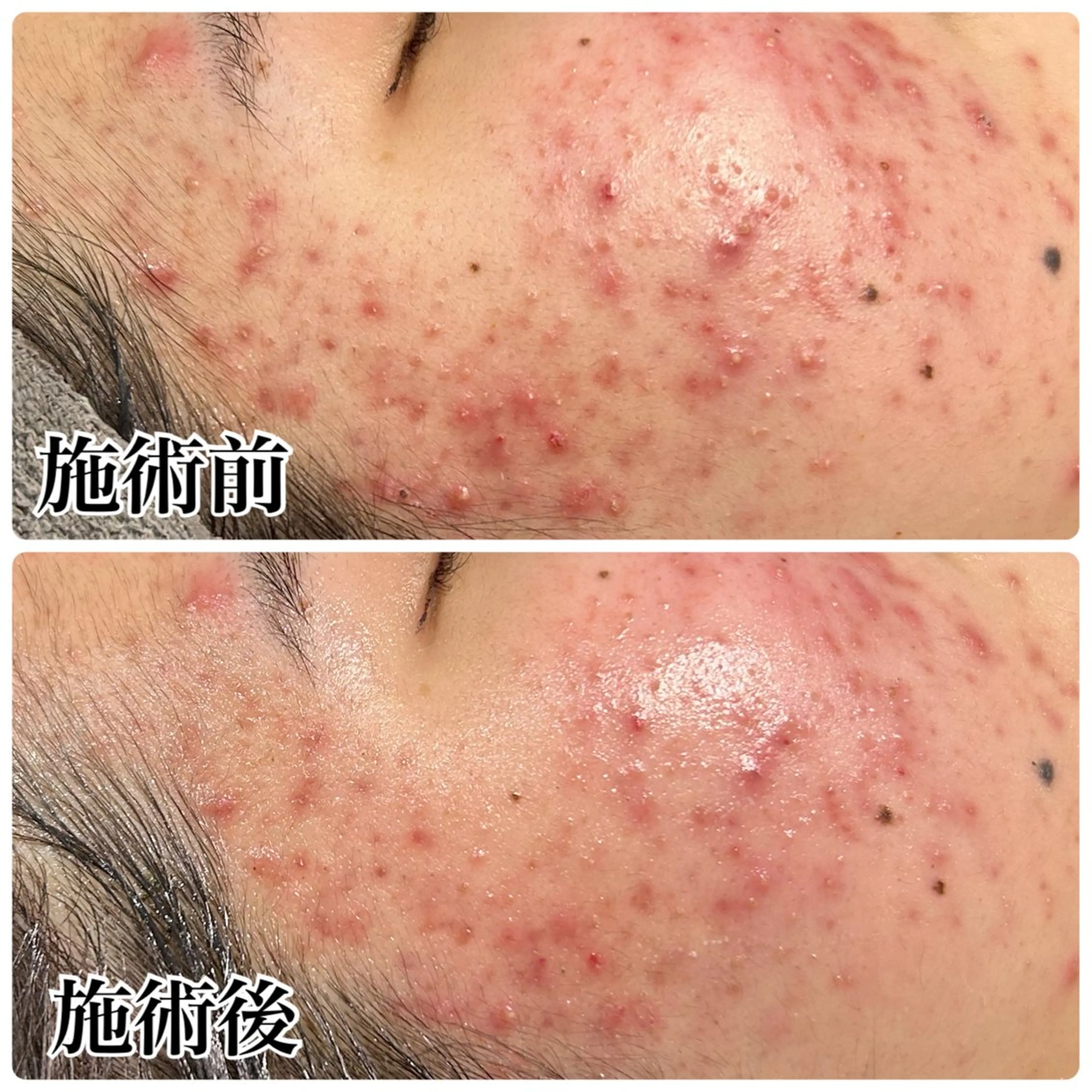 エステ Gemini 　MIKIのエステ・リラクイメージ