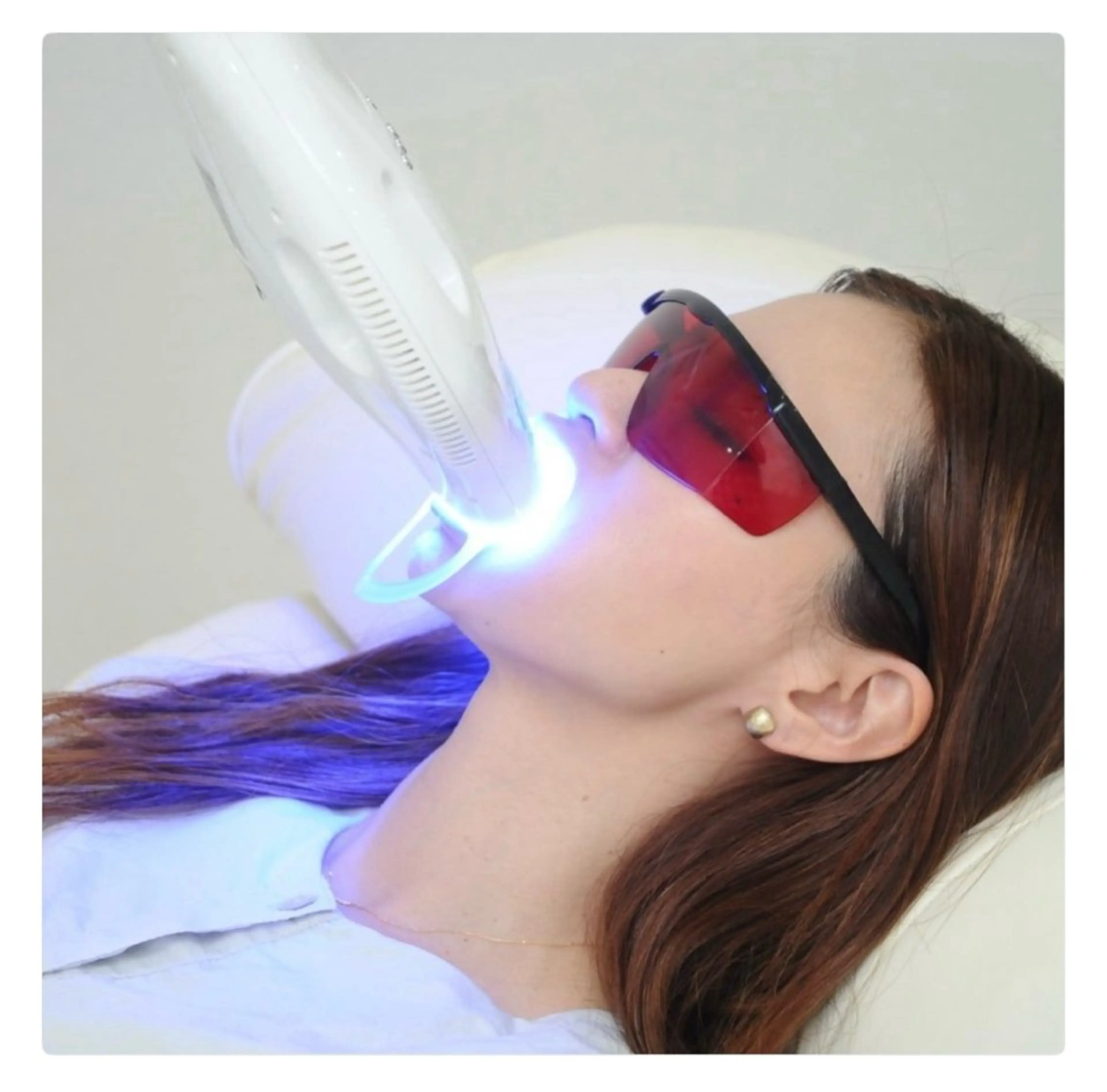 【2回目以降都度払いの方・単発で通いたい方】一度のご来店で45分照射！黄ばみや白さを実感したい方へ♪の写真