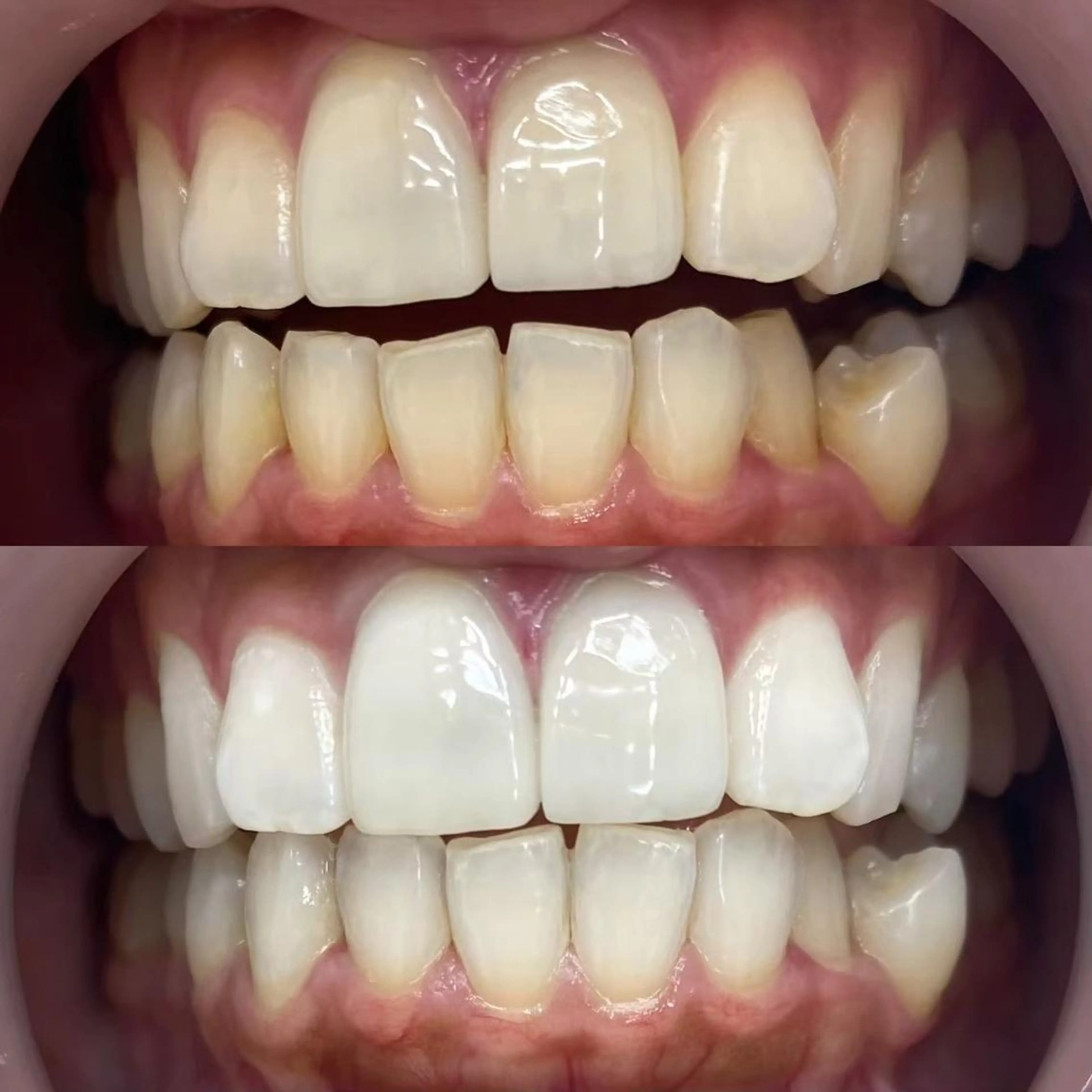 LBSホワイトニング 銀座店💎公式のその他イメージ