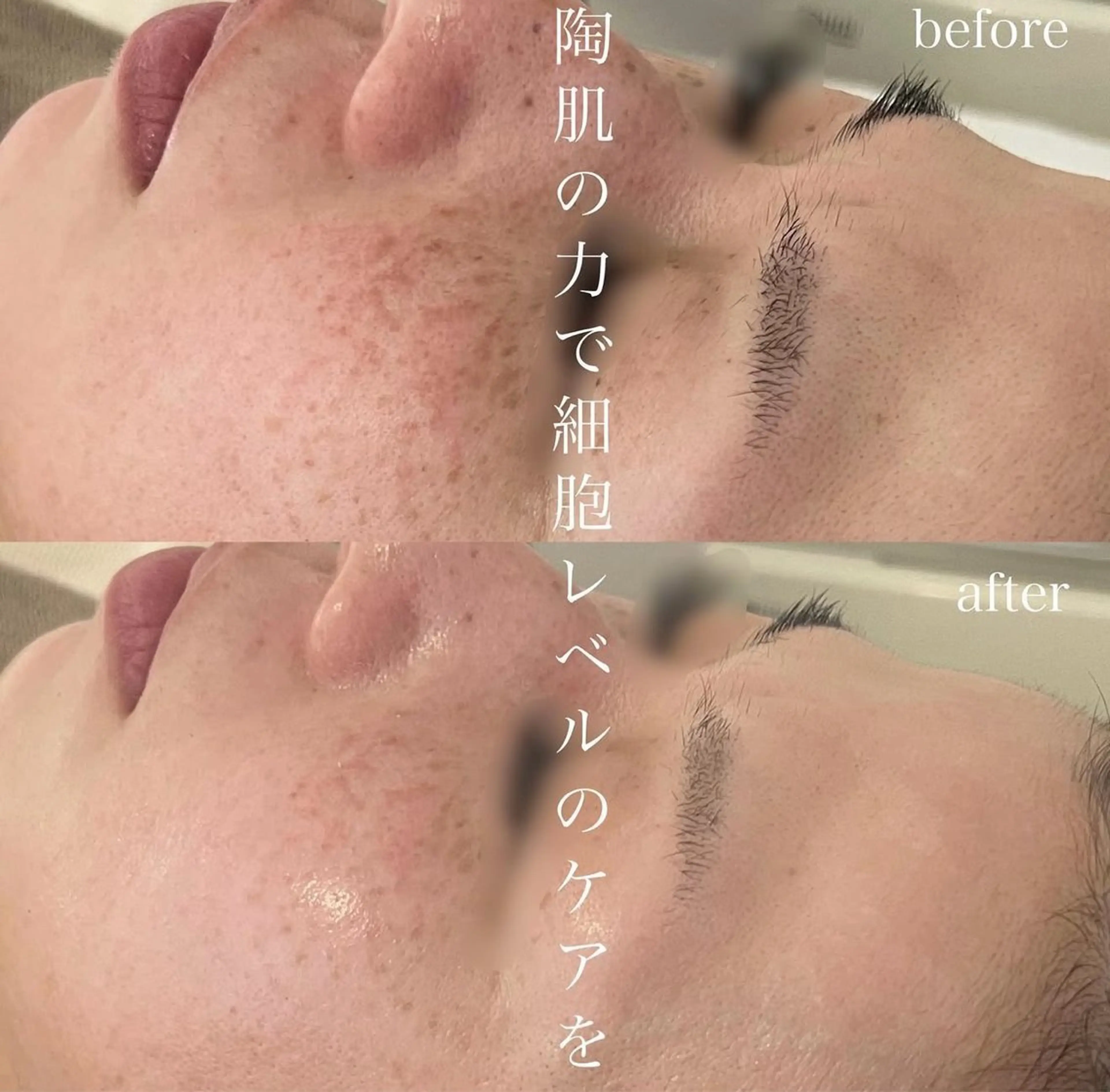 blan. beauty salon所属・blan. /岡本/ 神戸ハーブピーリングのエステ・リラクイメージ