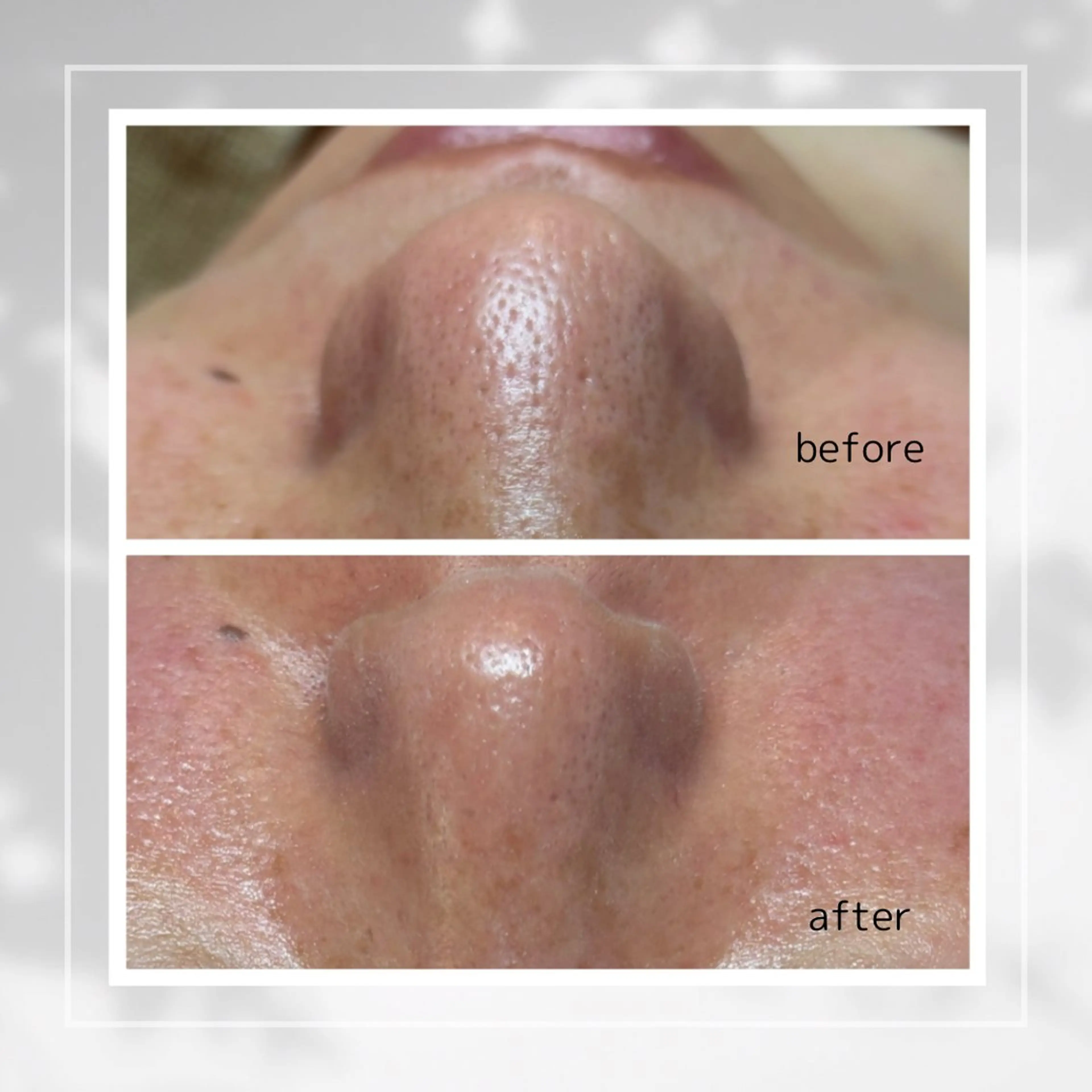 エステ 肌質改善フェイシャルCLEAR栄生/リンパ/毛穴/シミケア所属・井戸 麻衣のエステ・リラクイメージ