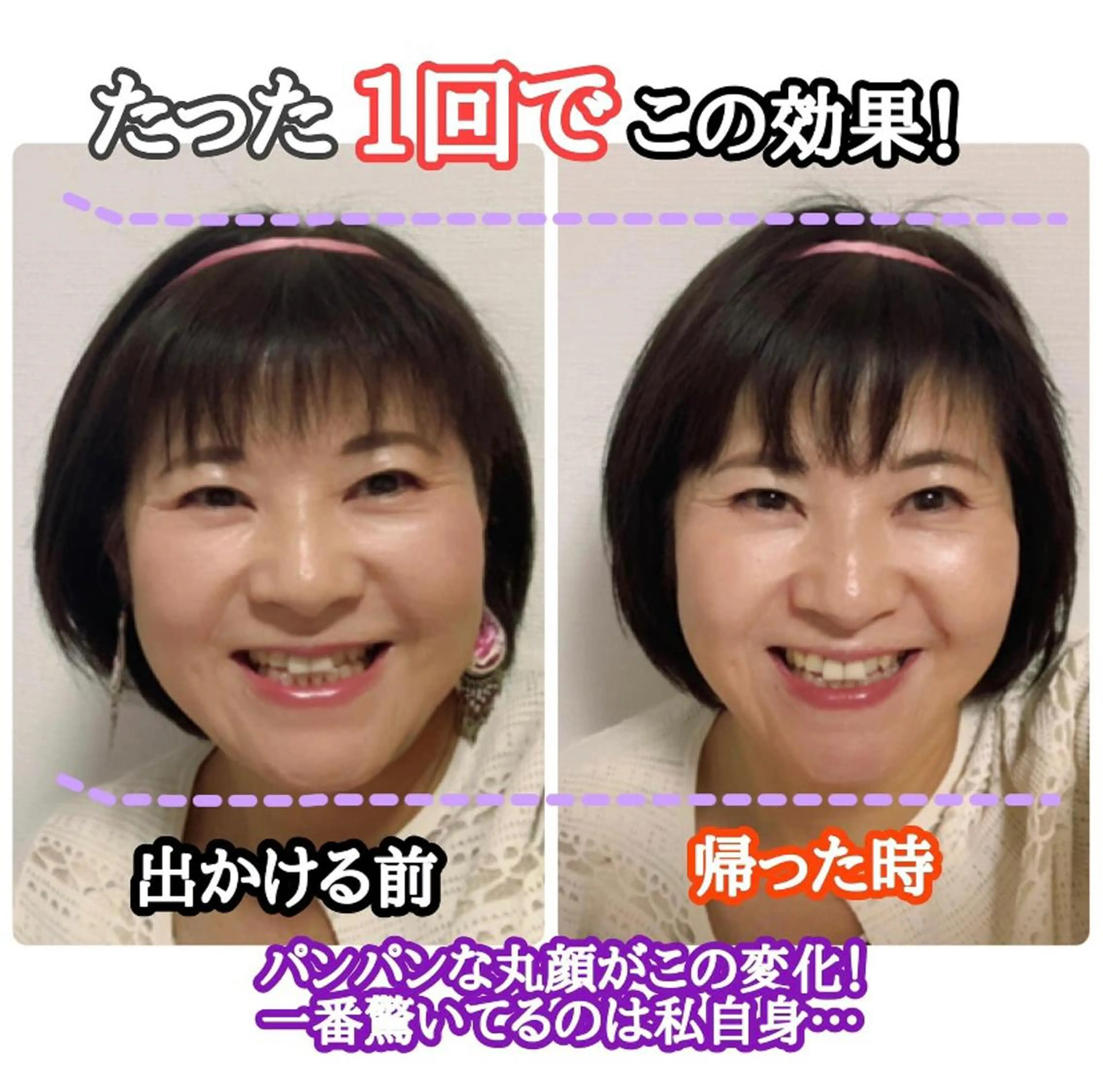 【小顔調整】オールハンドで行います。フェイスラインすっきり、エラや目元のたるみ、ほうれい線ケアにも◎の写真