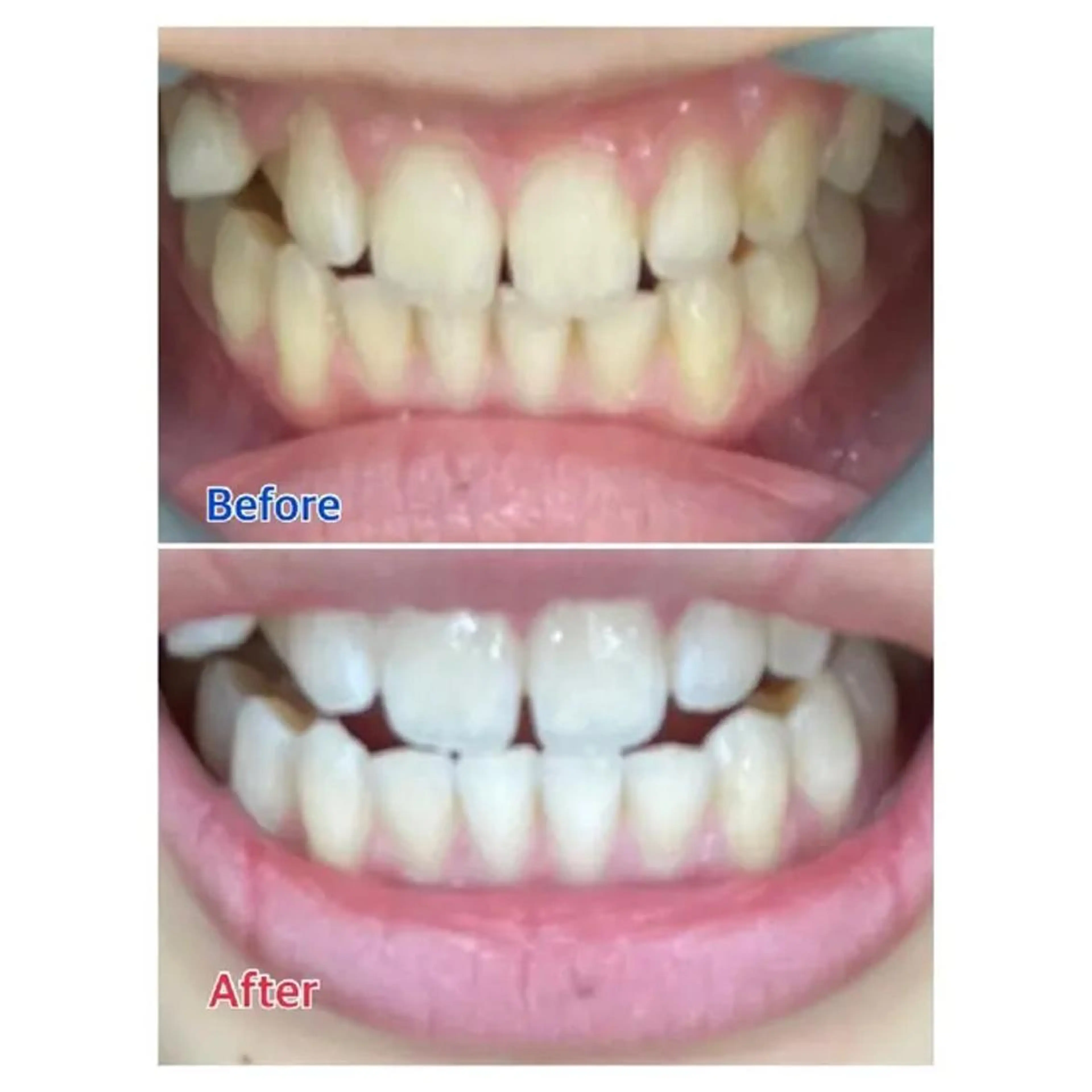 M渋谷店所属・M渋谷 ホワイトニングのエステ・リラクイメージ