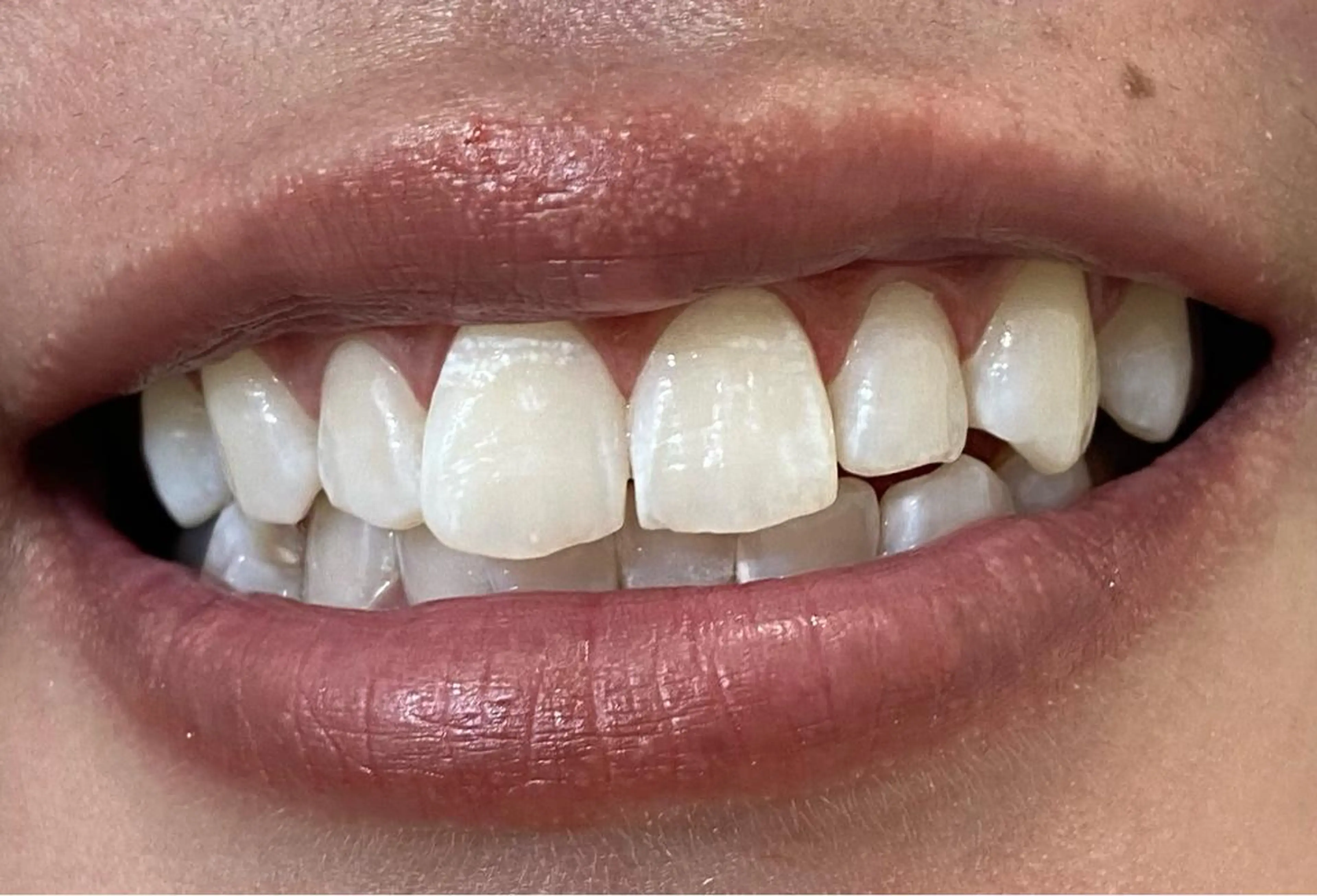 セルフホワイトニングサロン　ラヴィアン所属・ホワイトニングサロン La vie enのその他イメージ