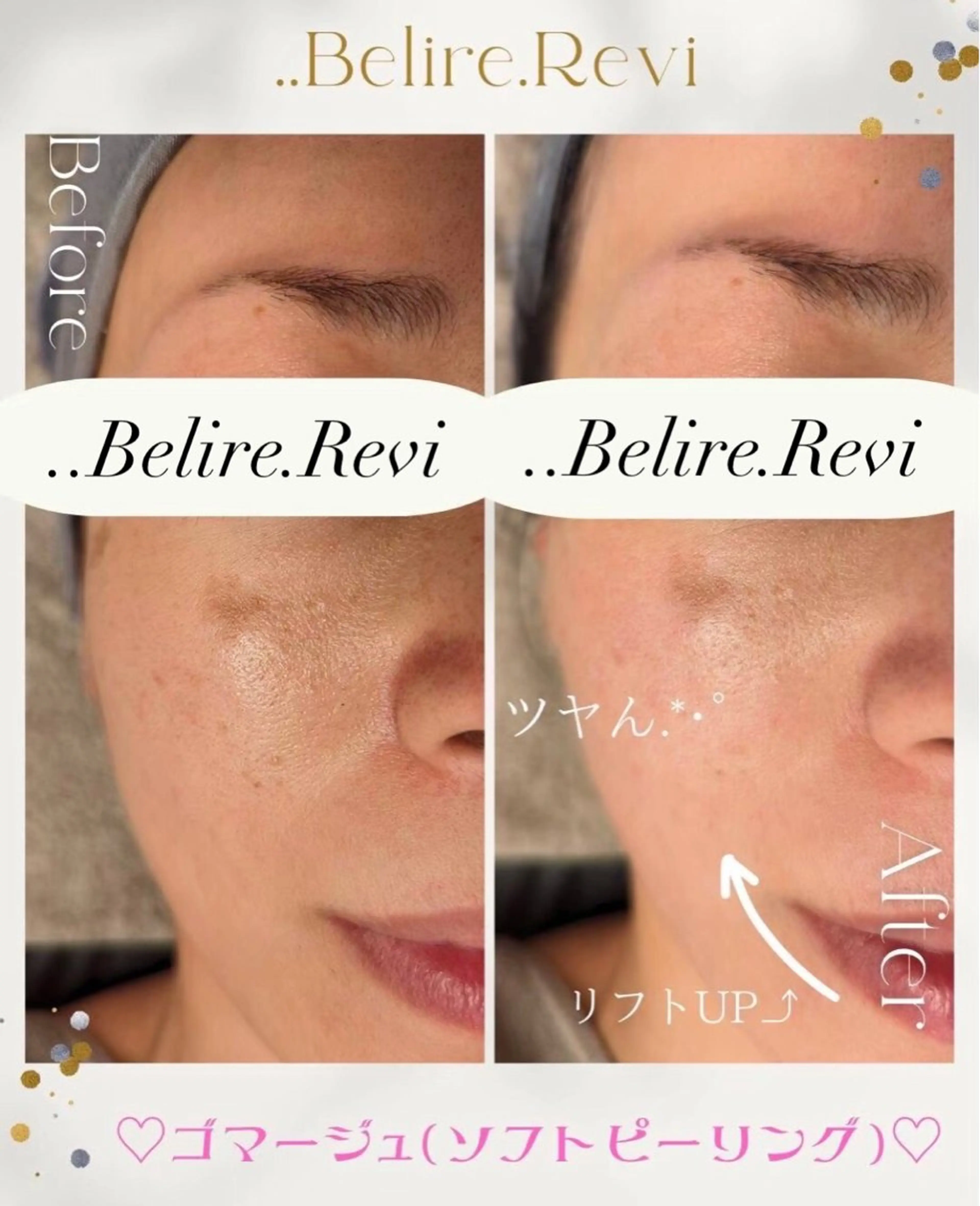 ..Belire.Revi所属・ベリールルヴィ ベリールルヴィのエステ・リラクイメージ