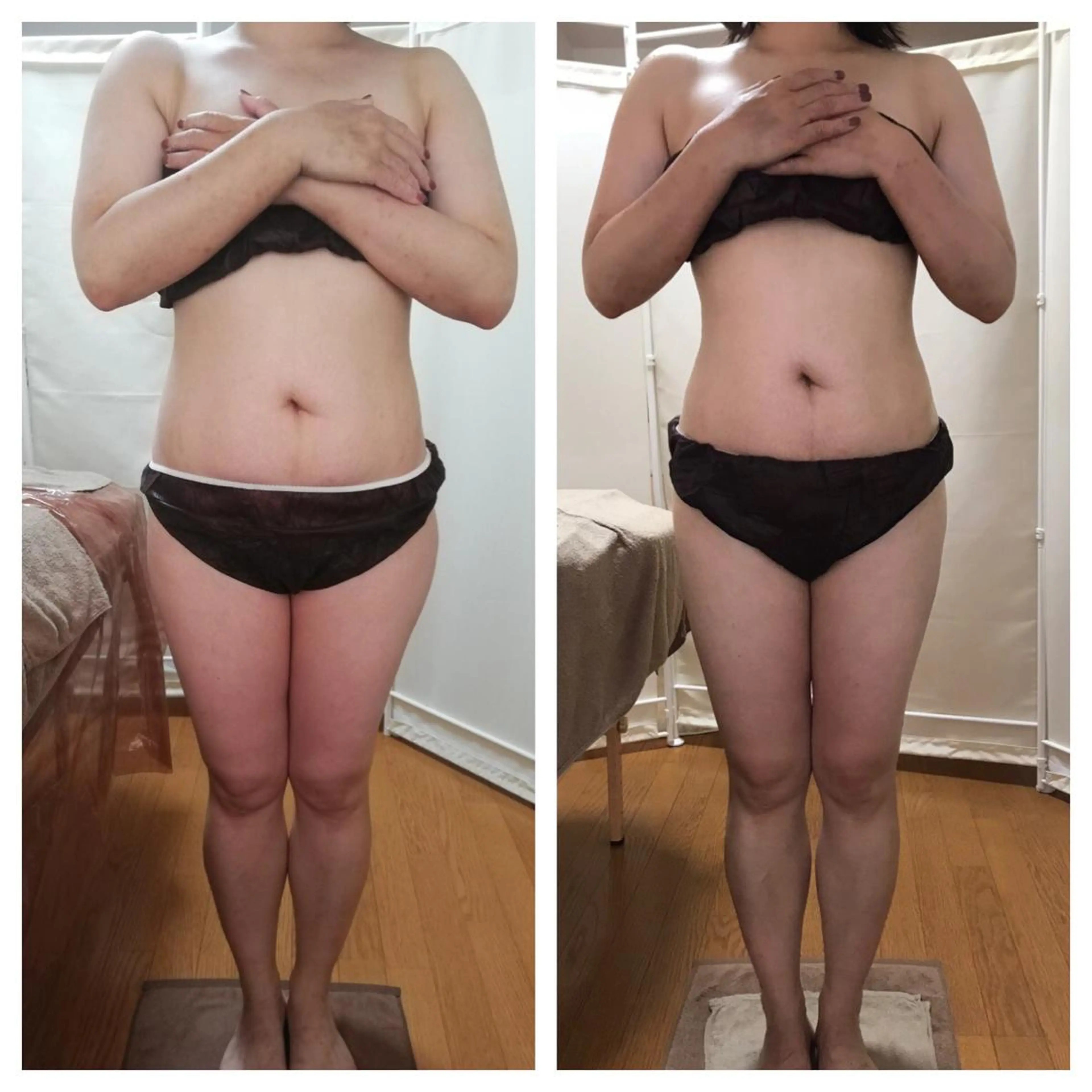 biloop所属・《痩身×疲労改善》 BILOOPのエステ・リラクイメージ