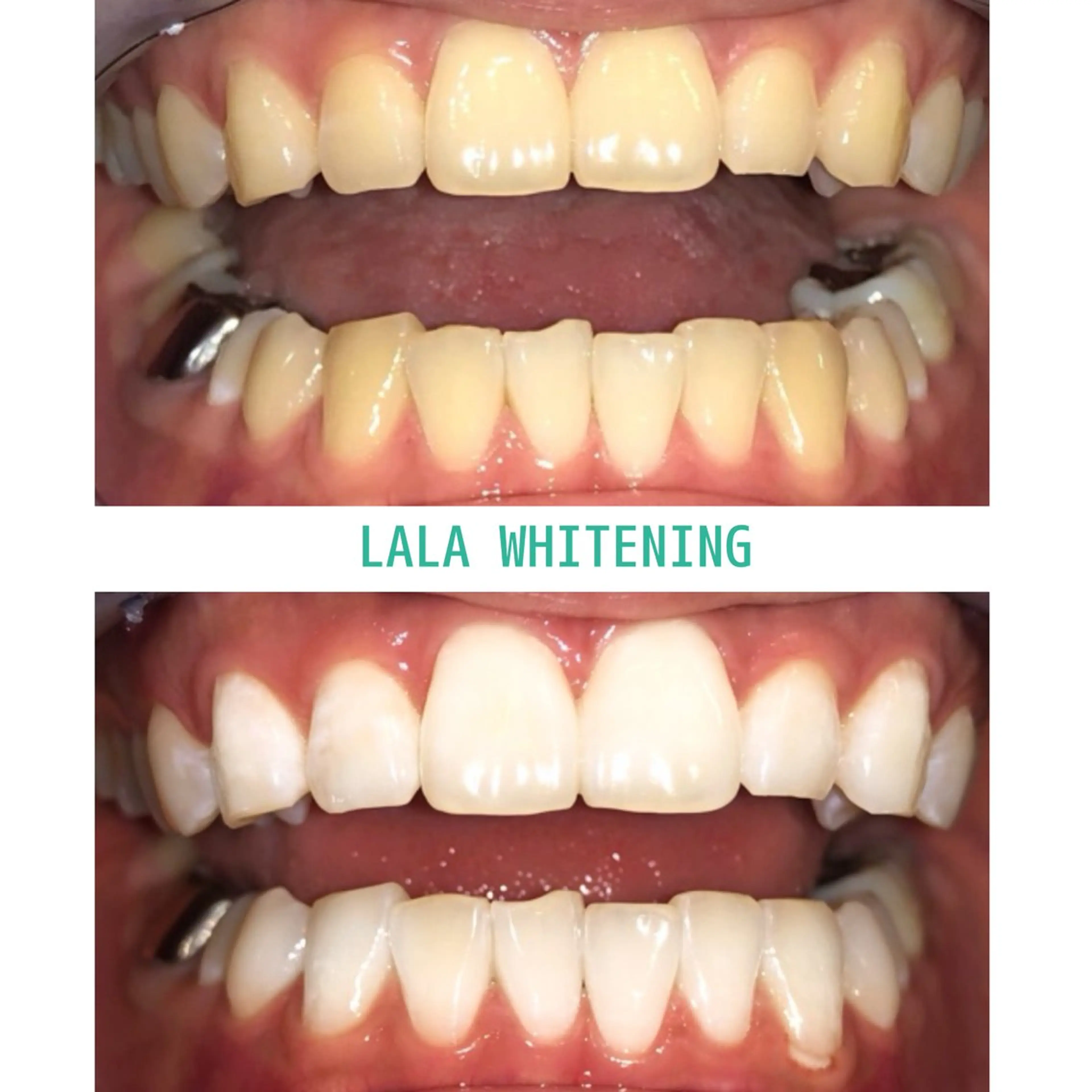 ララホワイトニング  大分駅前店所属・ララホワイトニング 大分駅前店のその他イメージ