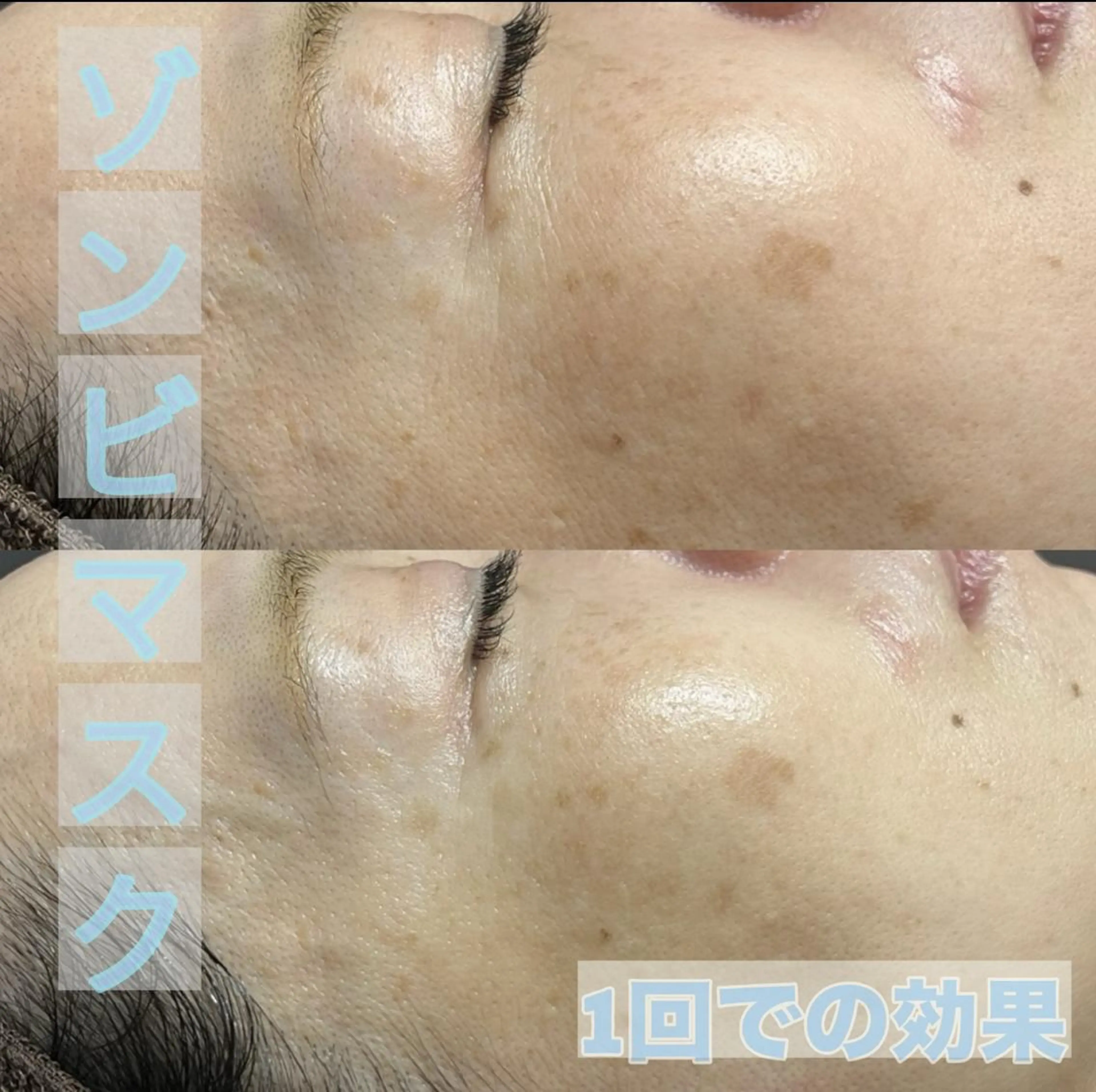 SNS大人気/塗るボトックス✨話題のゾンビマスク🚹🚺の写真