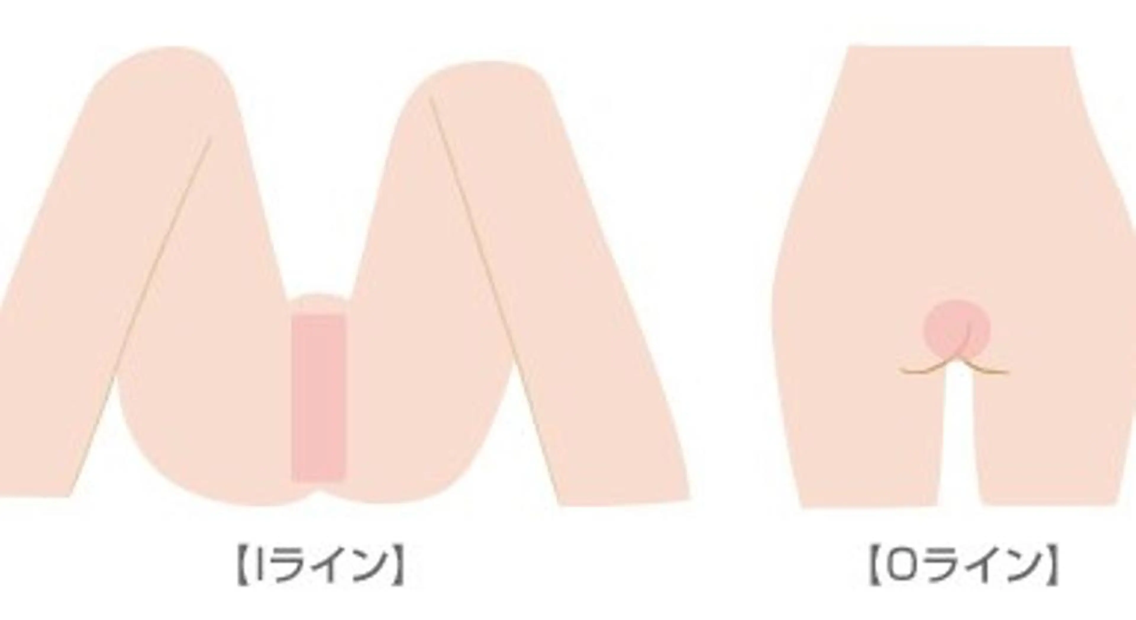 【その日にスッキリ♪】ブラジリアンシュガーリング/IOライン(回数:1回)【女性限定】の写真